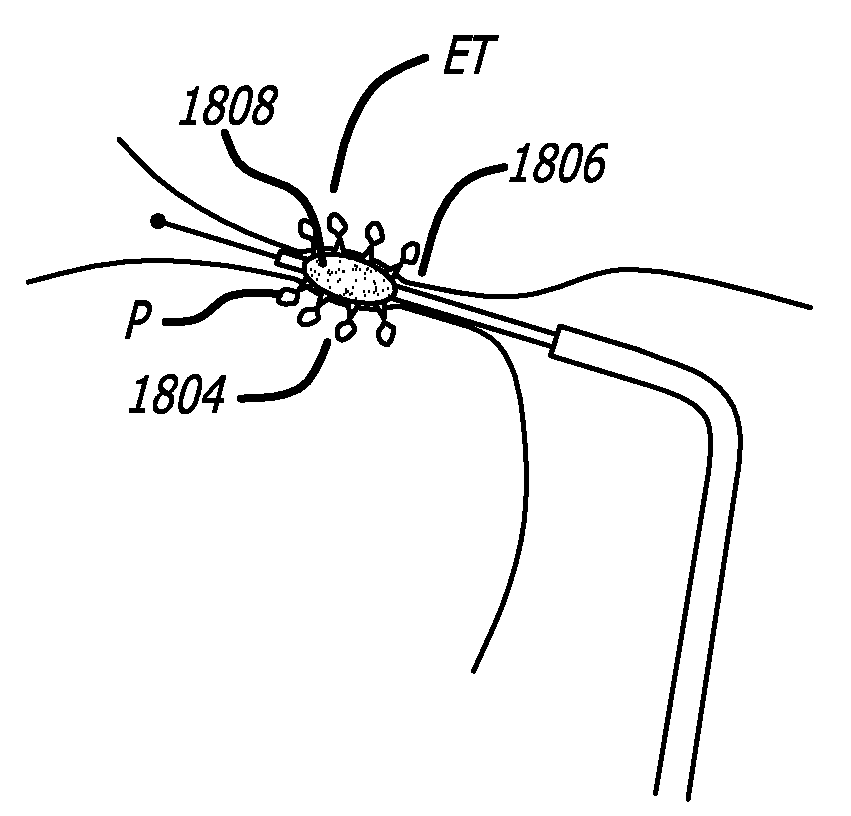 Method and system for treating target tissue within the eustachian tube
