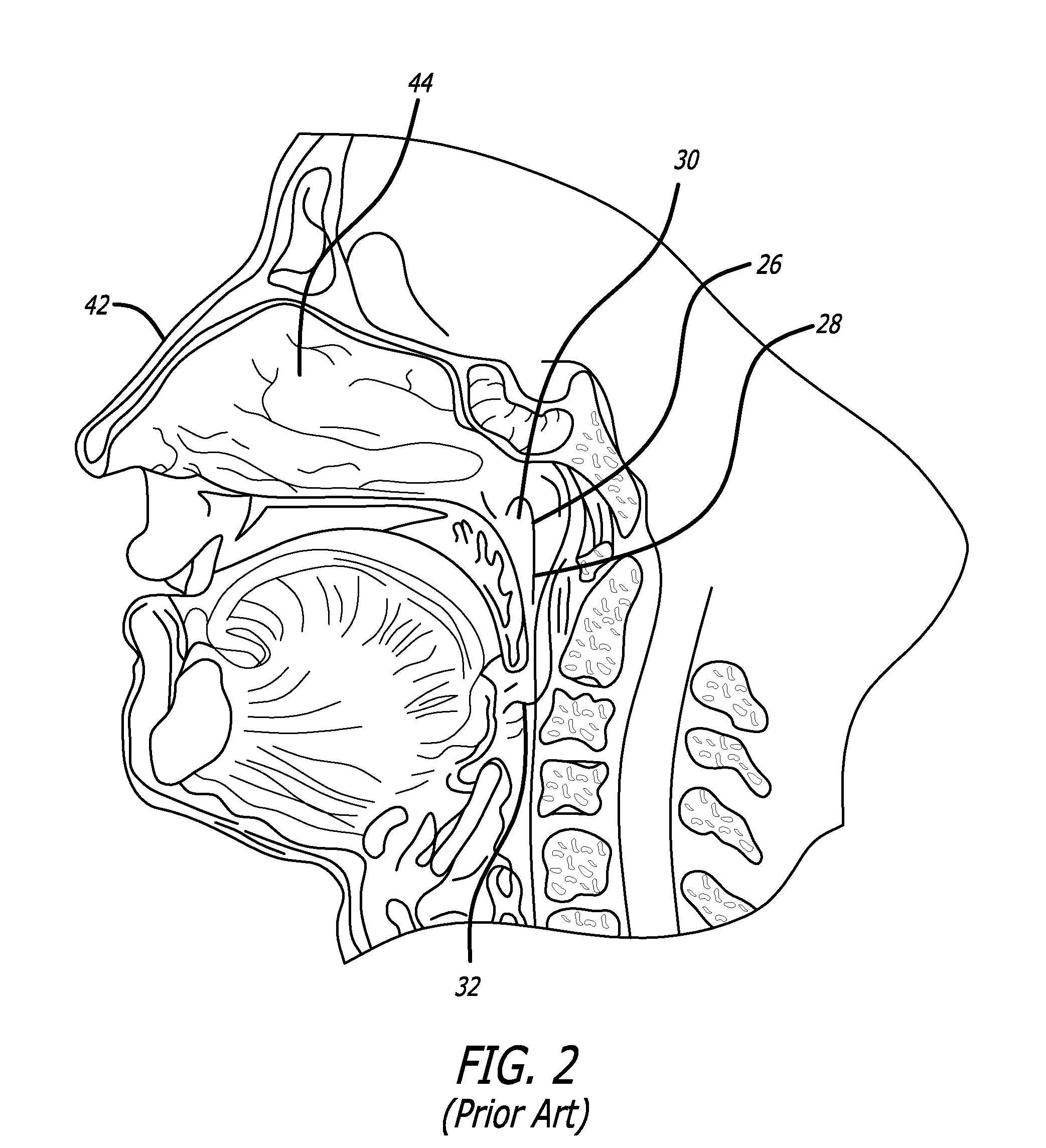 Method and system for treating target tissue within the eustachian tube