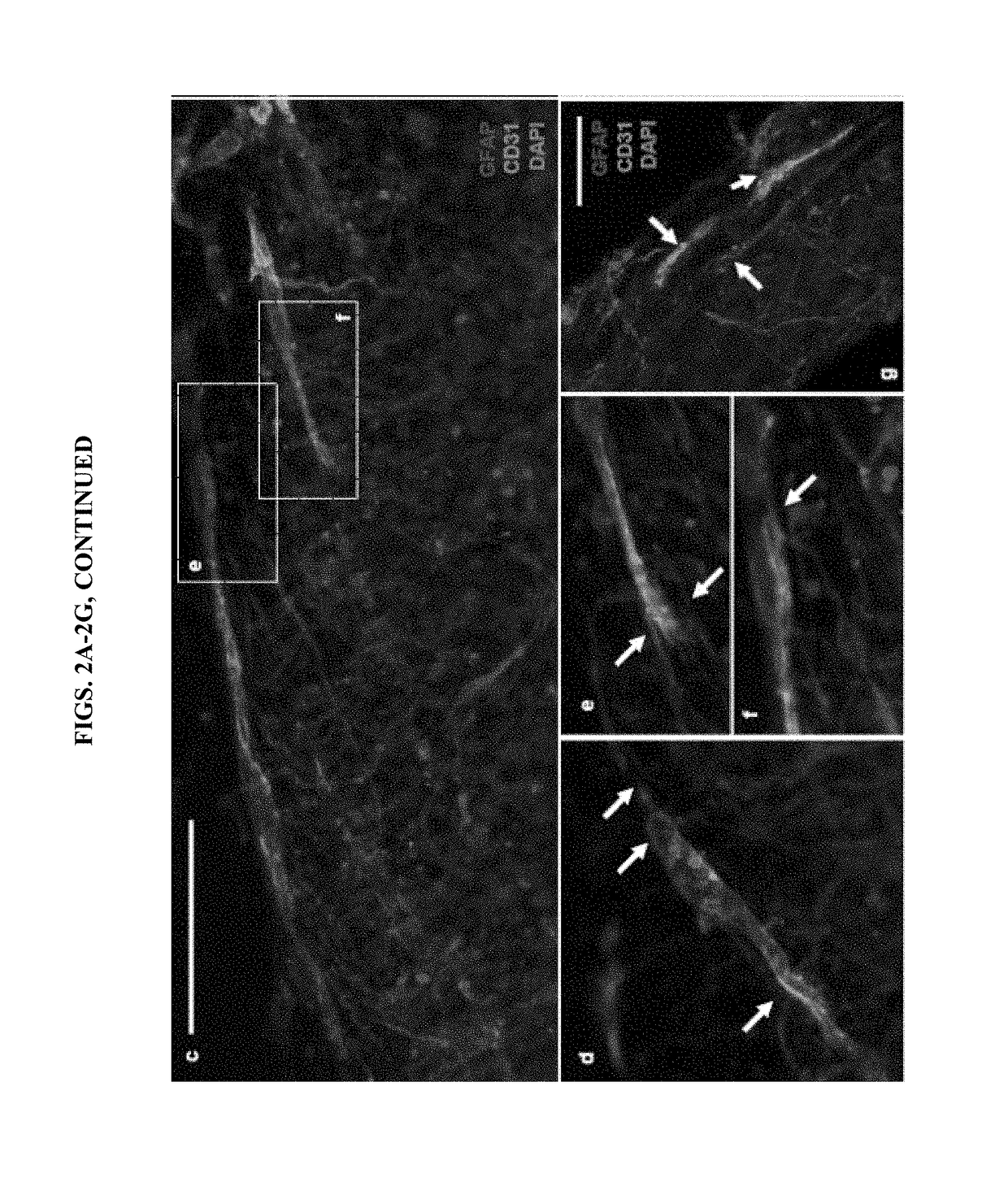 Derivation of human microglia from pluripotent stem cells