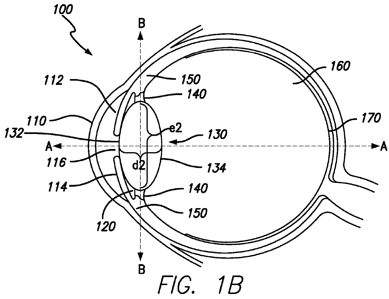 Method and system for adjusting the refractive power of an implanted intraocular lens