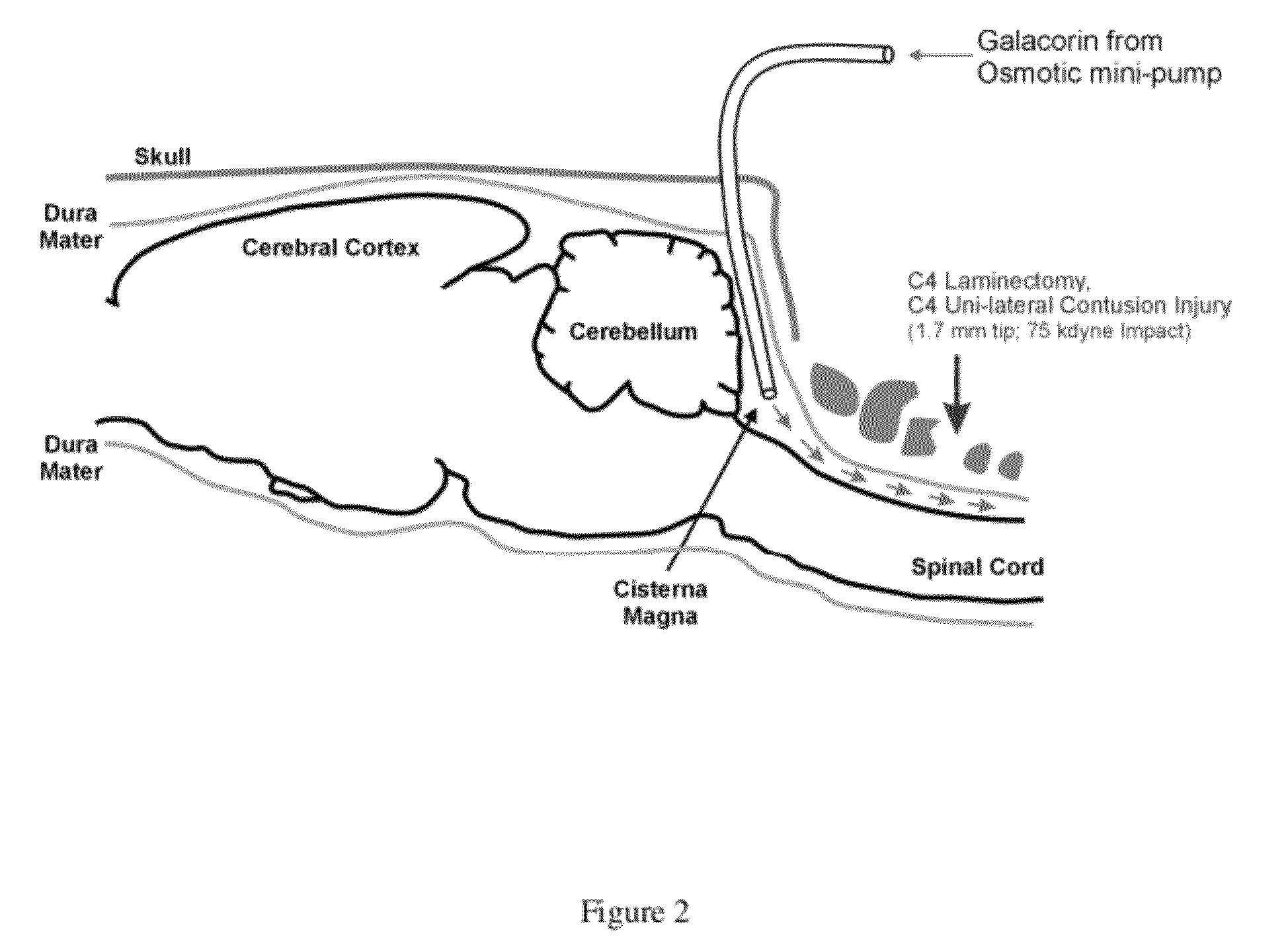 Methods for treating neurological conditions and compositions and materials therefor