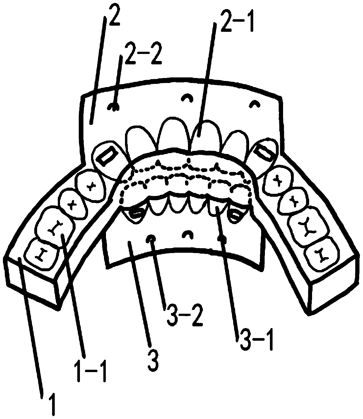 Orthodontic orthognathic surgery positioning device