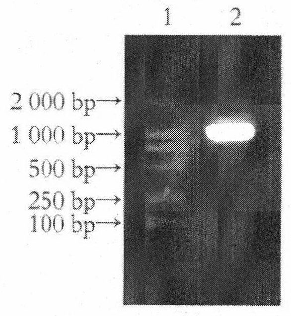 DcR3 (Decoy Receptor 3) and GAD65 (Glutamic Acid Decarboxylase 65) double gene co-expression recombinant adenovirus as well as preparation method and application thereof
