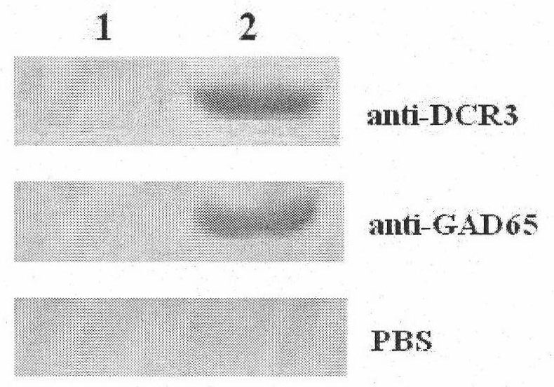 DcR3 (Decoy Receptor 3) and GAD65 (Glutamic Acid Decarboxylase 65) double gene co-expression recombinant adenovirus as well as preparation method and application thereof