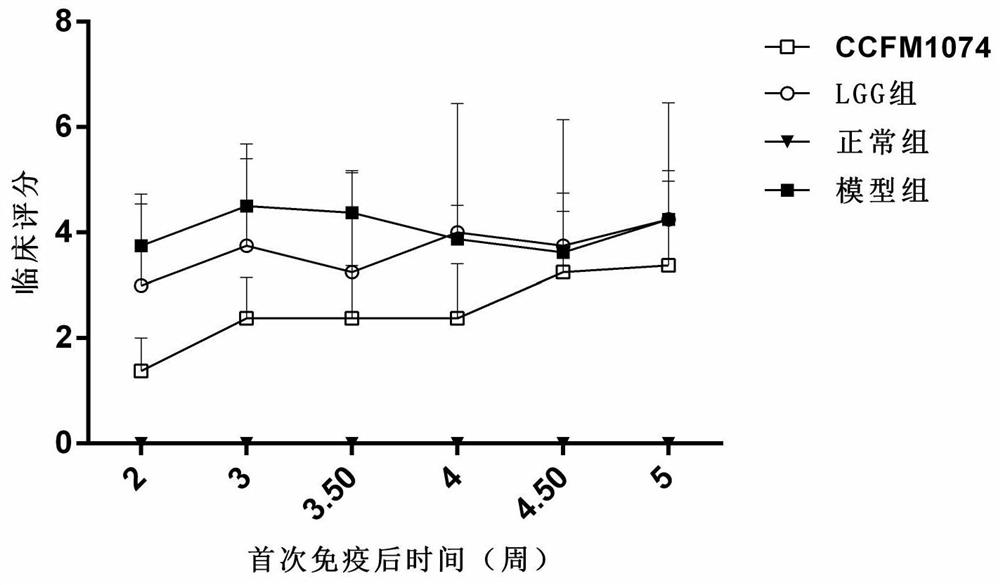 A strain of Lactobacillus casei that can alleviate rheumatoid arthritis and its application