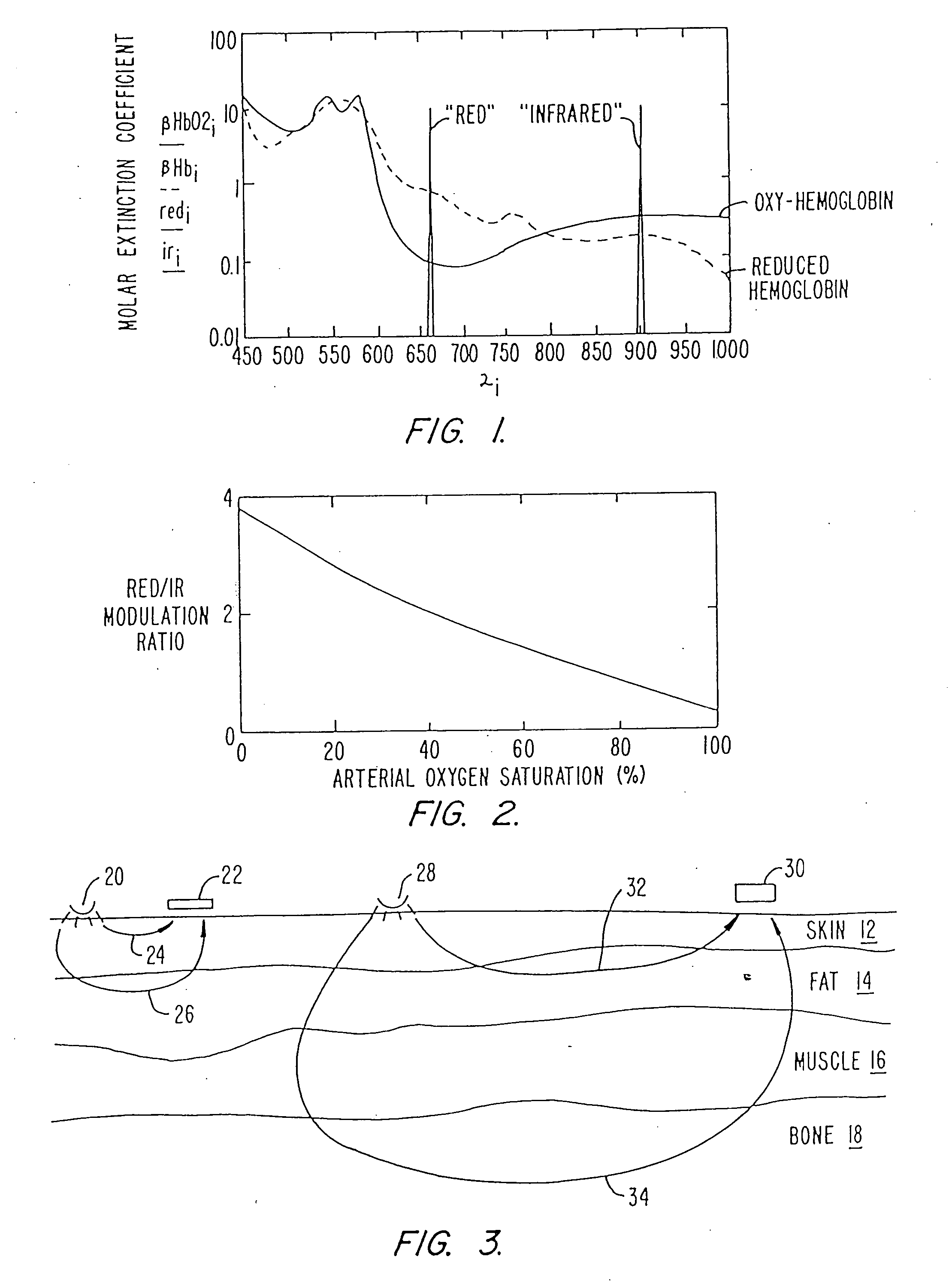 Pulse oximeter and sensor optimized for low saturation