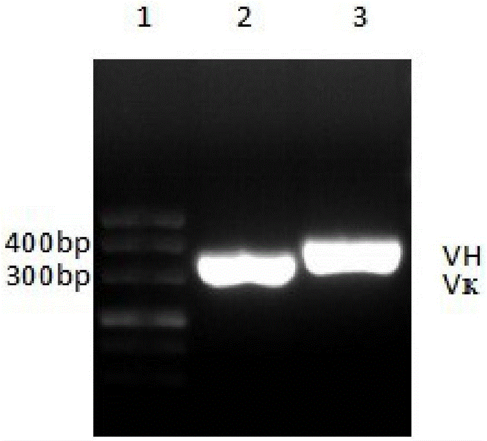 T lymphocyte modified by Trop2 chimeric antigen receptor and application thereof