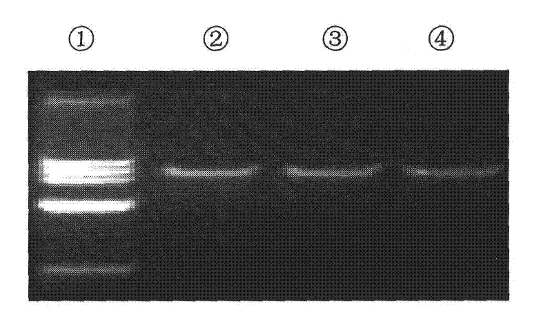 Construction and screening of siRNAs (small interfering RANs) expression vectors of gastric cancer targeted DEC1 (differentiated embryo-chondrocyte expressed gene 1) and application thereof