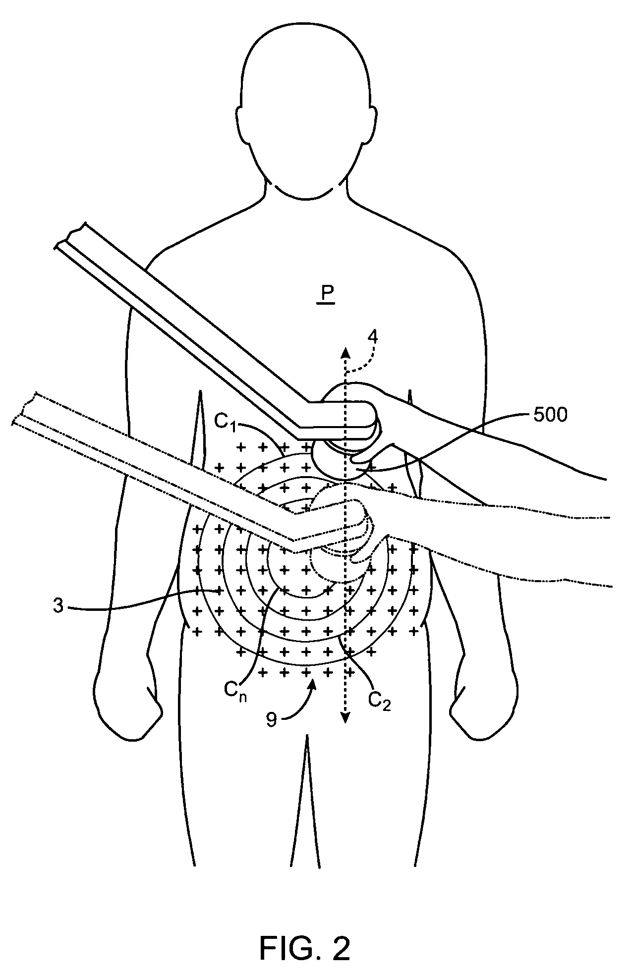 Apparatus and methods for the destruction of adipose tissue