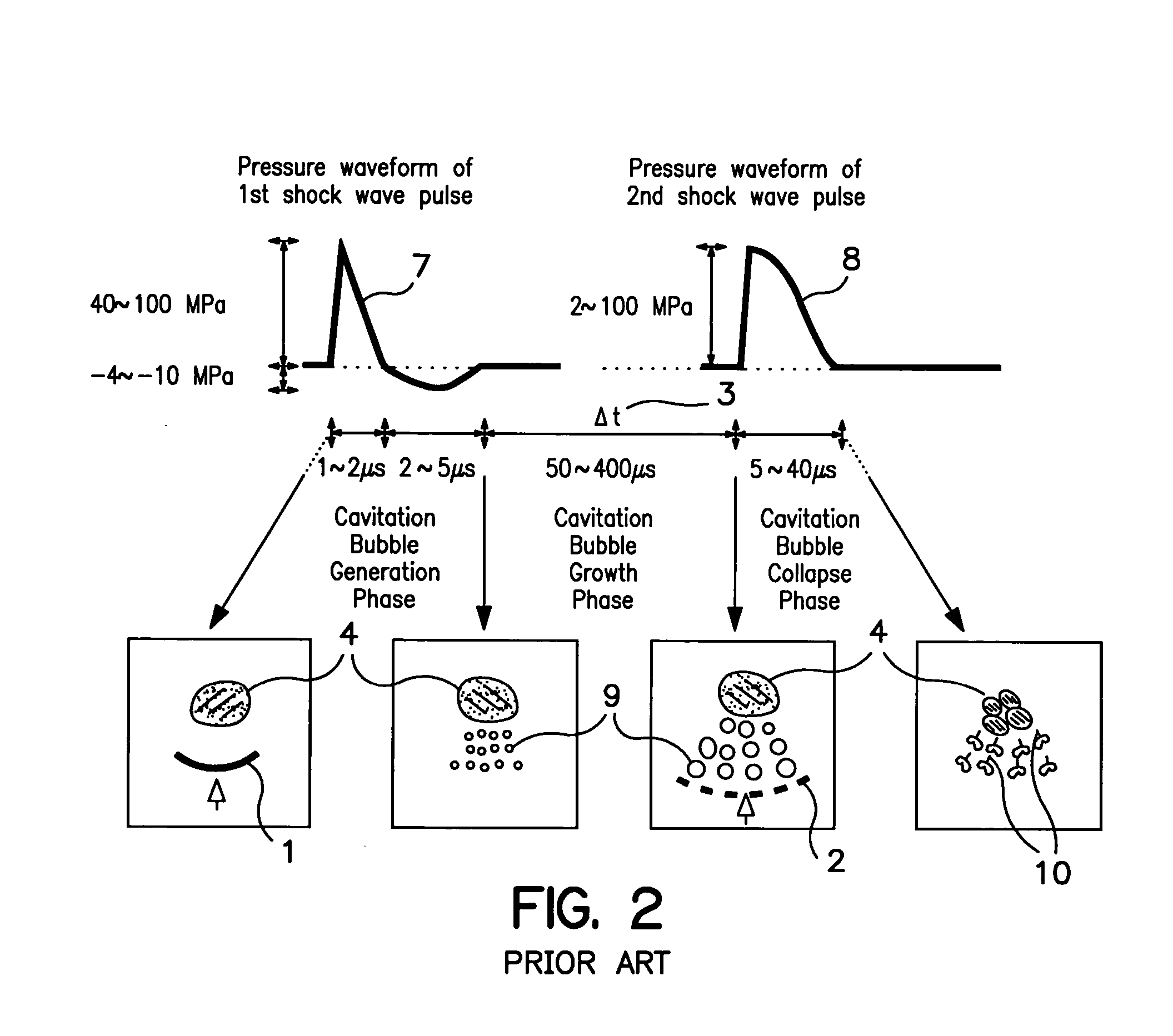 Apparatus for improved shock-wave lithotripsy (SWL) using a piezoelectric annular array (PEAA) shock-wave generator in combination with a primary shock wave source