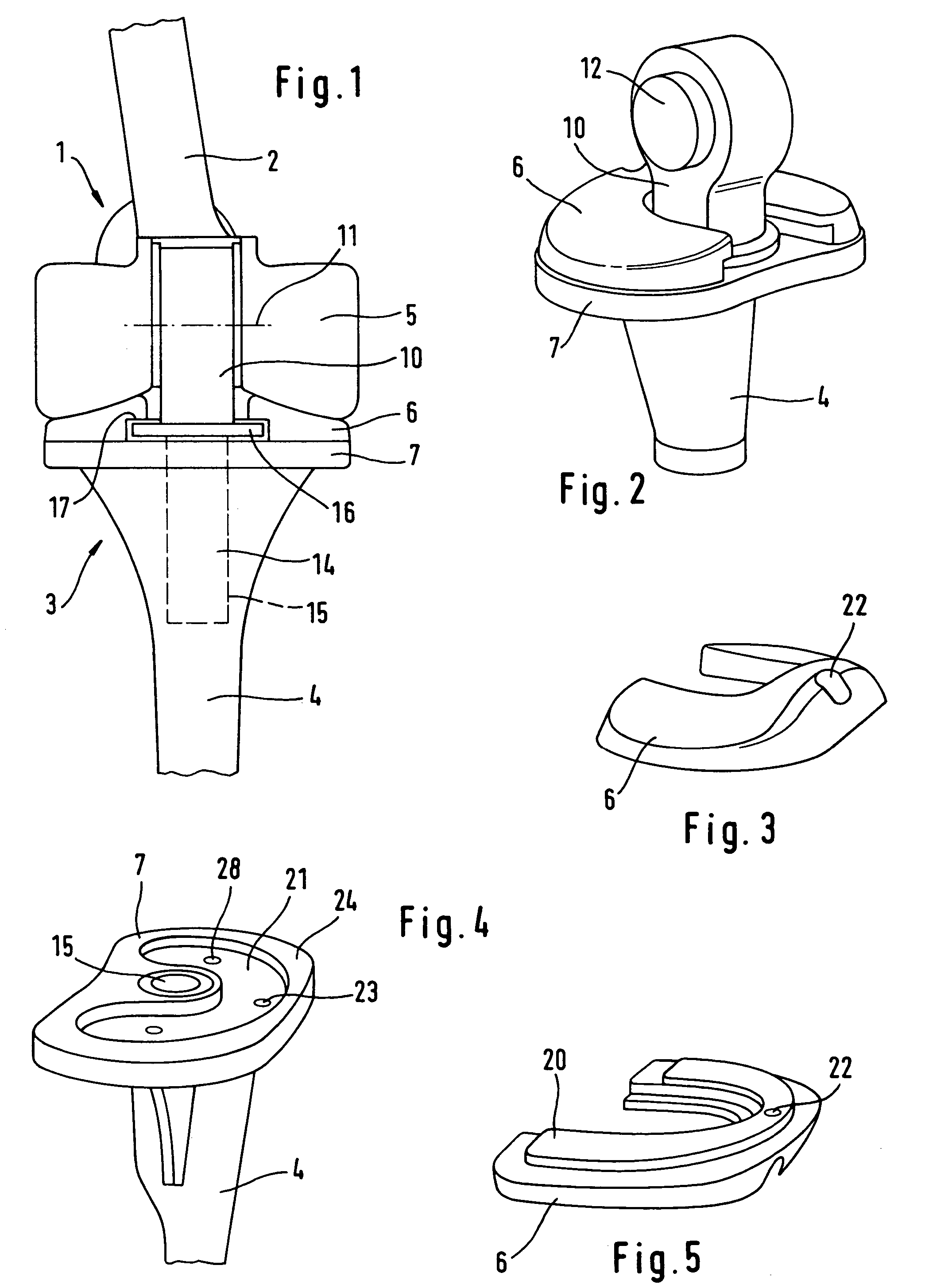 Knee prosthesis with rotation bearing