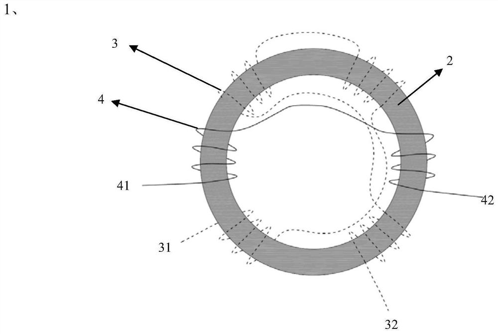 Large diameter and high sensitivity high voltage DC cable leakage current detection sensor