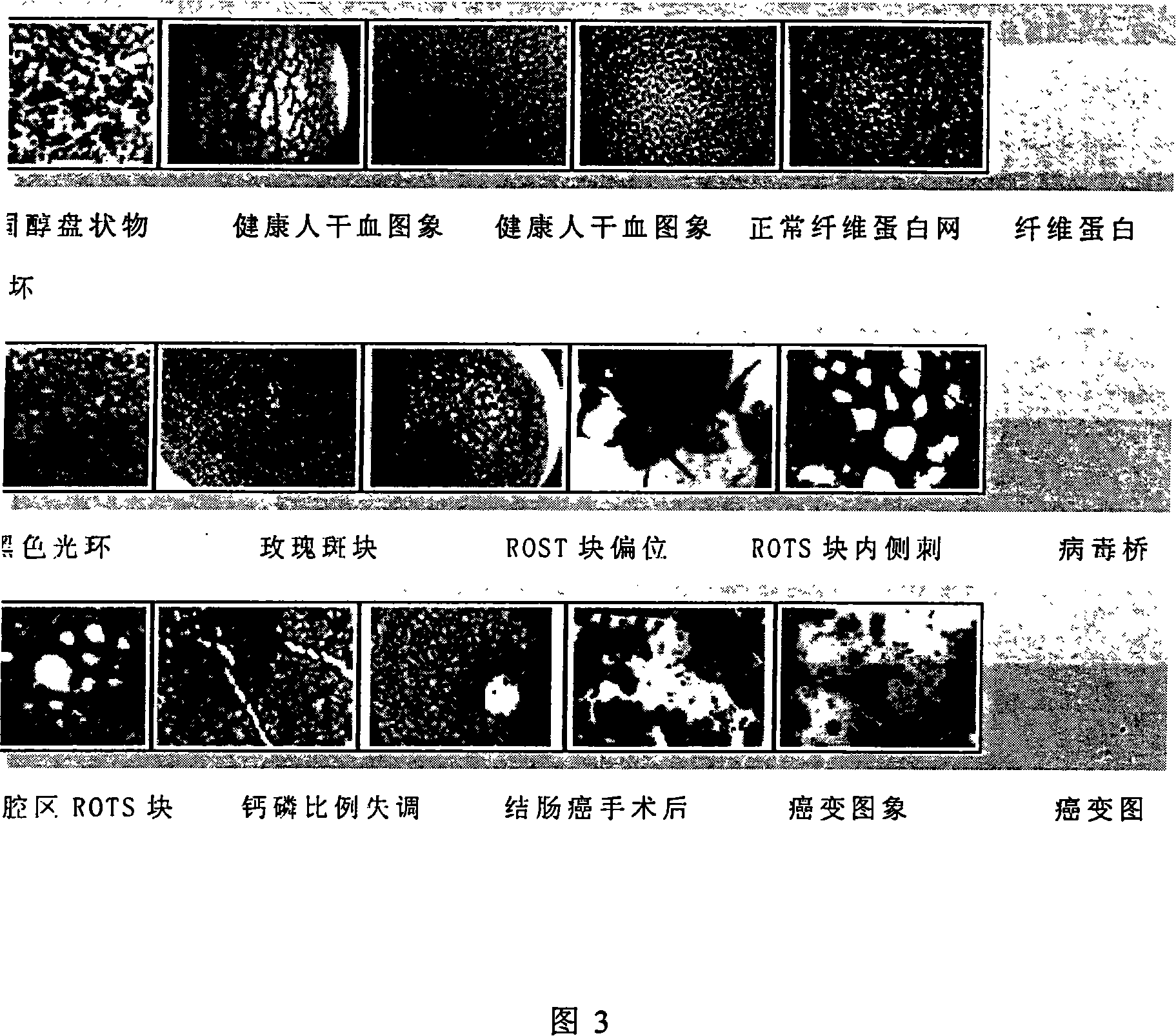 Early stage physical mutation forecasting system