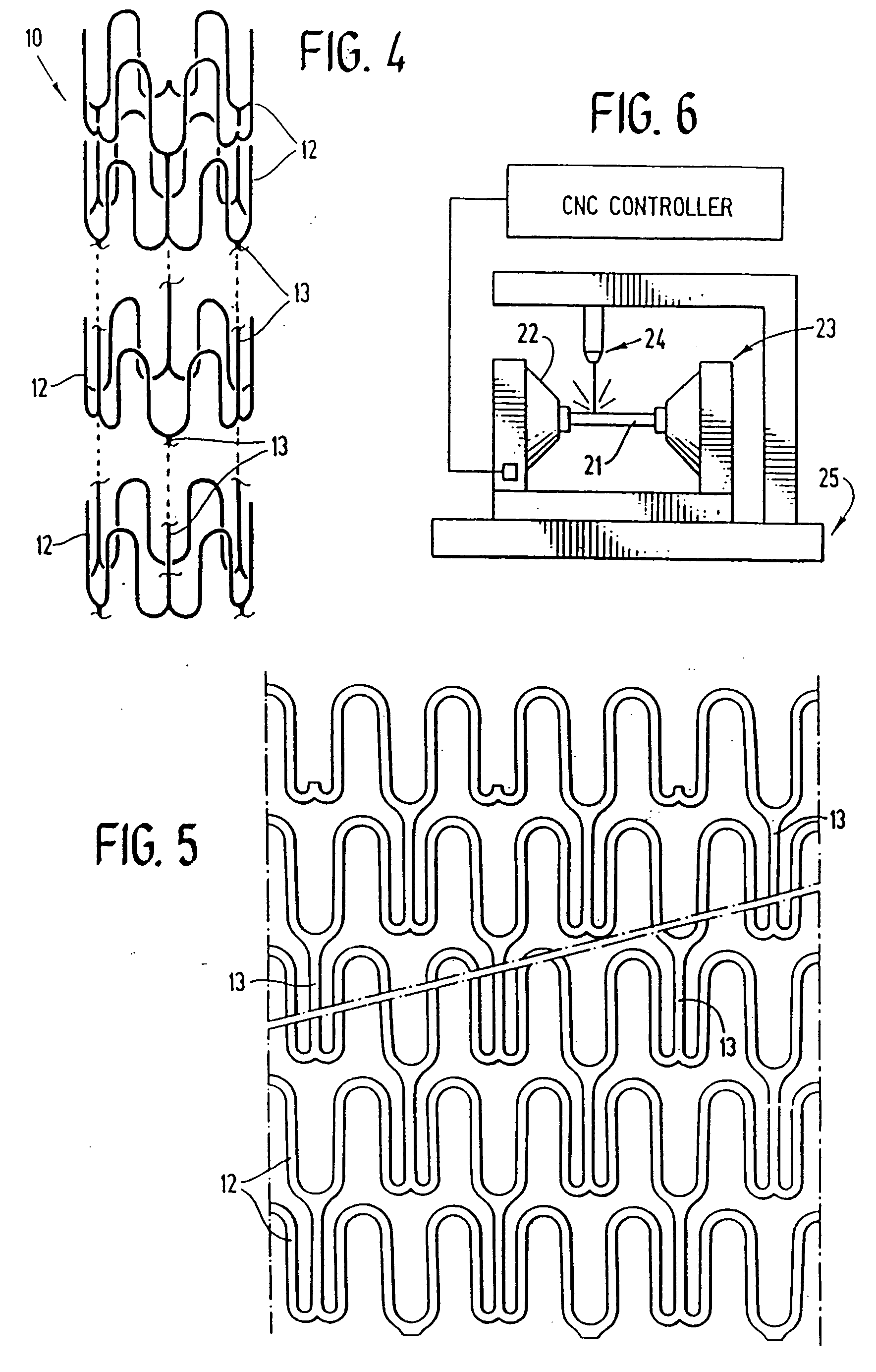 Expandable stents and method for making same