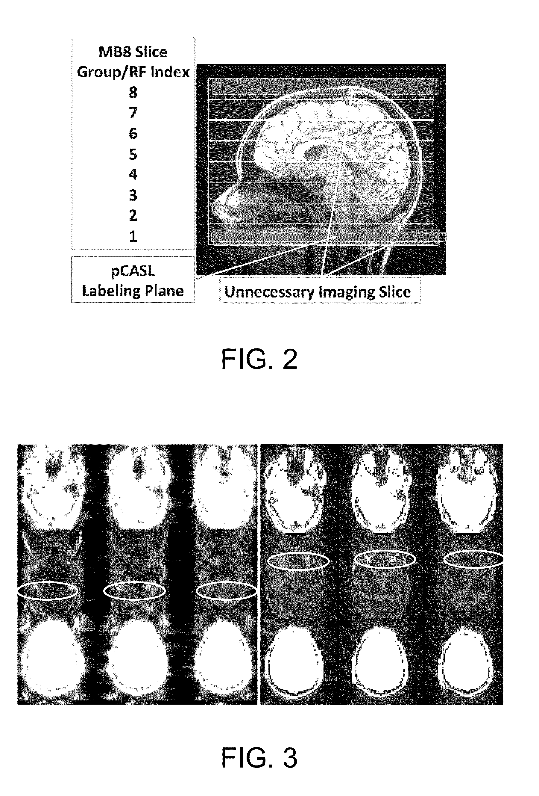 Apparatus And Method For Multi-Band MR Imaging