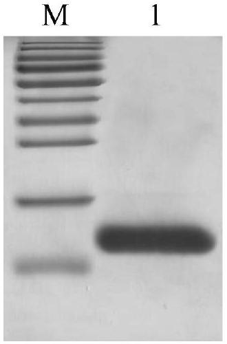 Method for extracting nerve growth factor