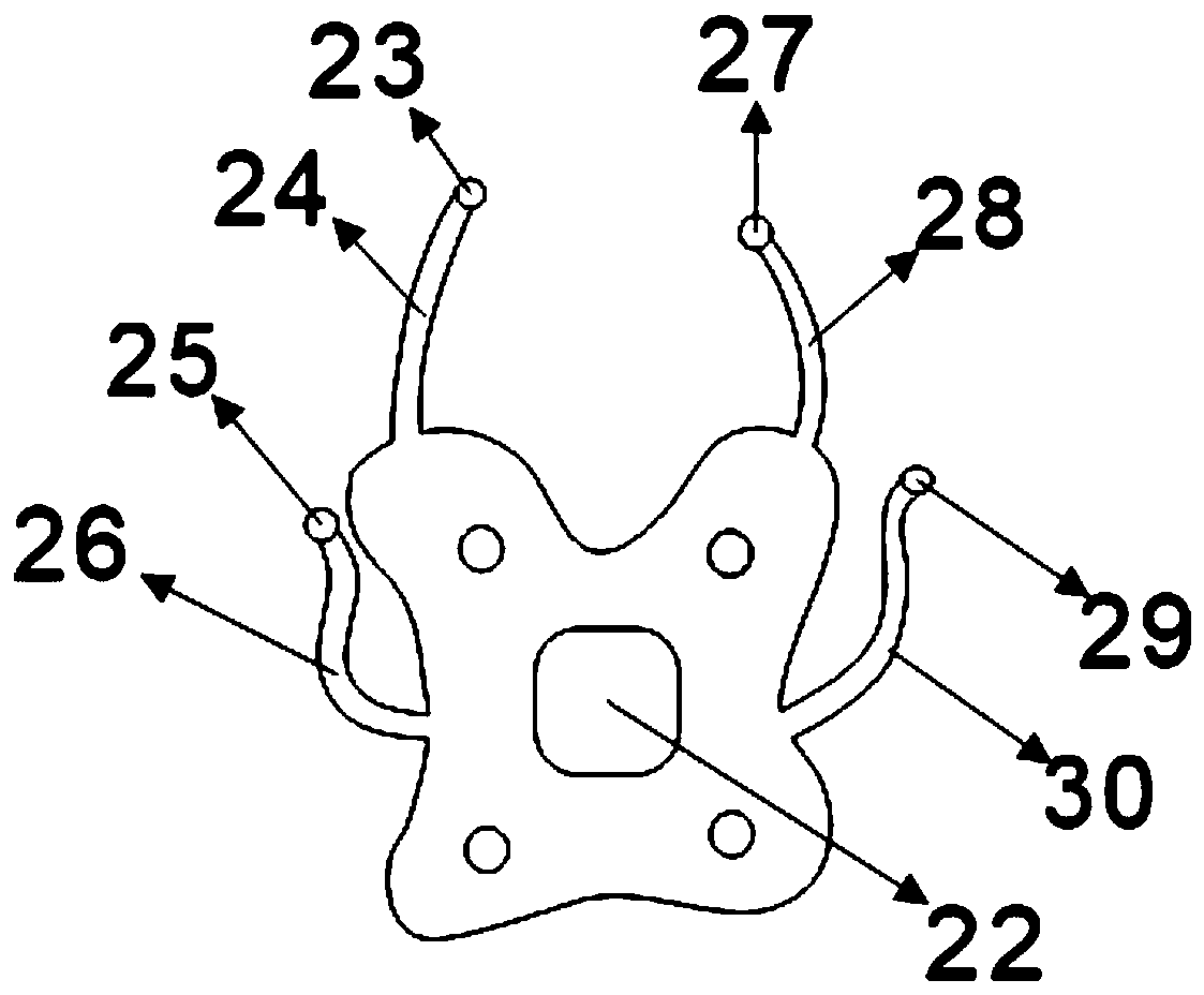 3D printing pediatric torticollis postoperative correction brace