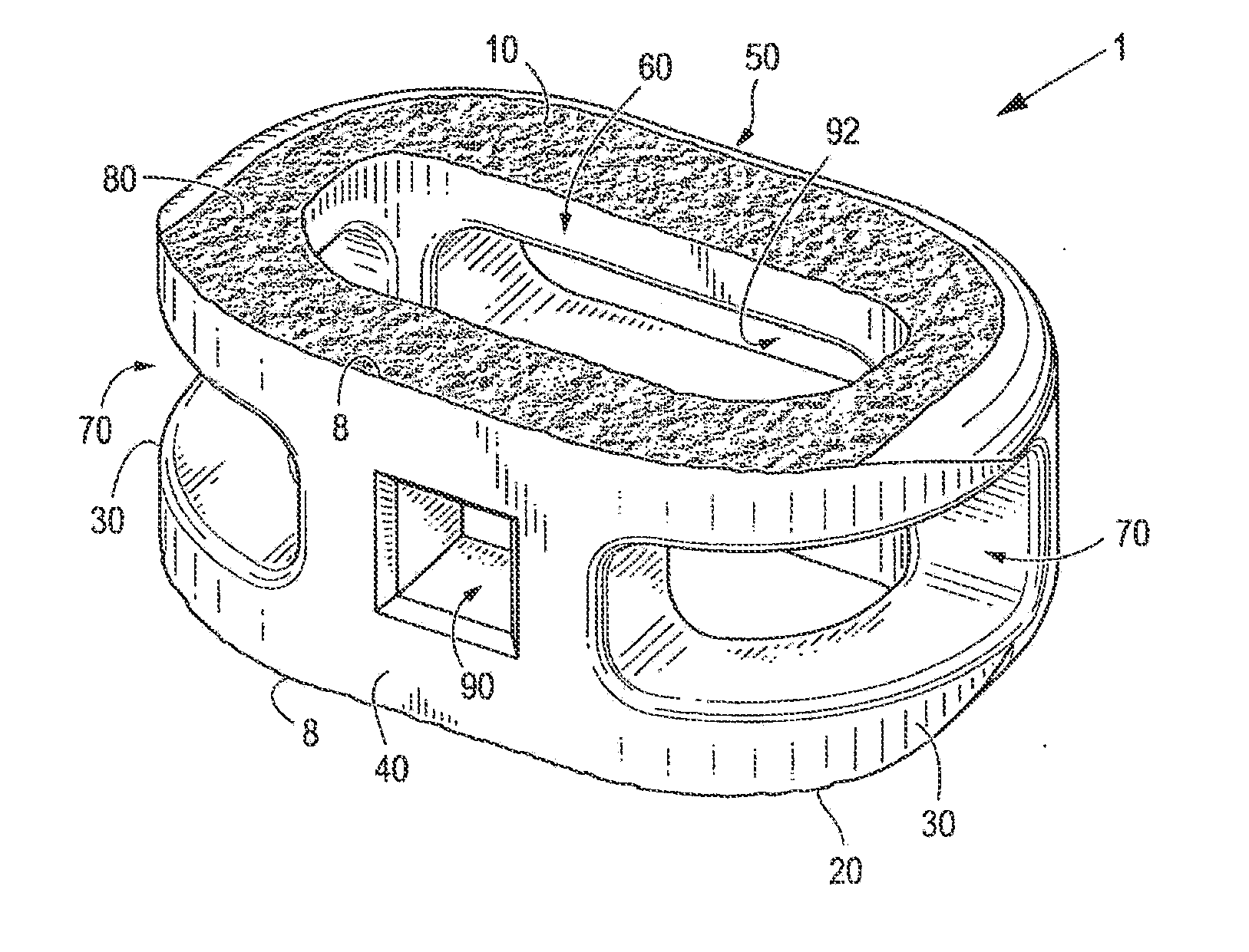 Implant with critical ratio of load bearing surface area to central opening area