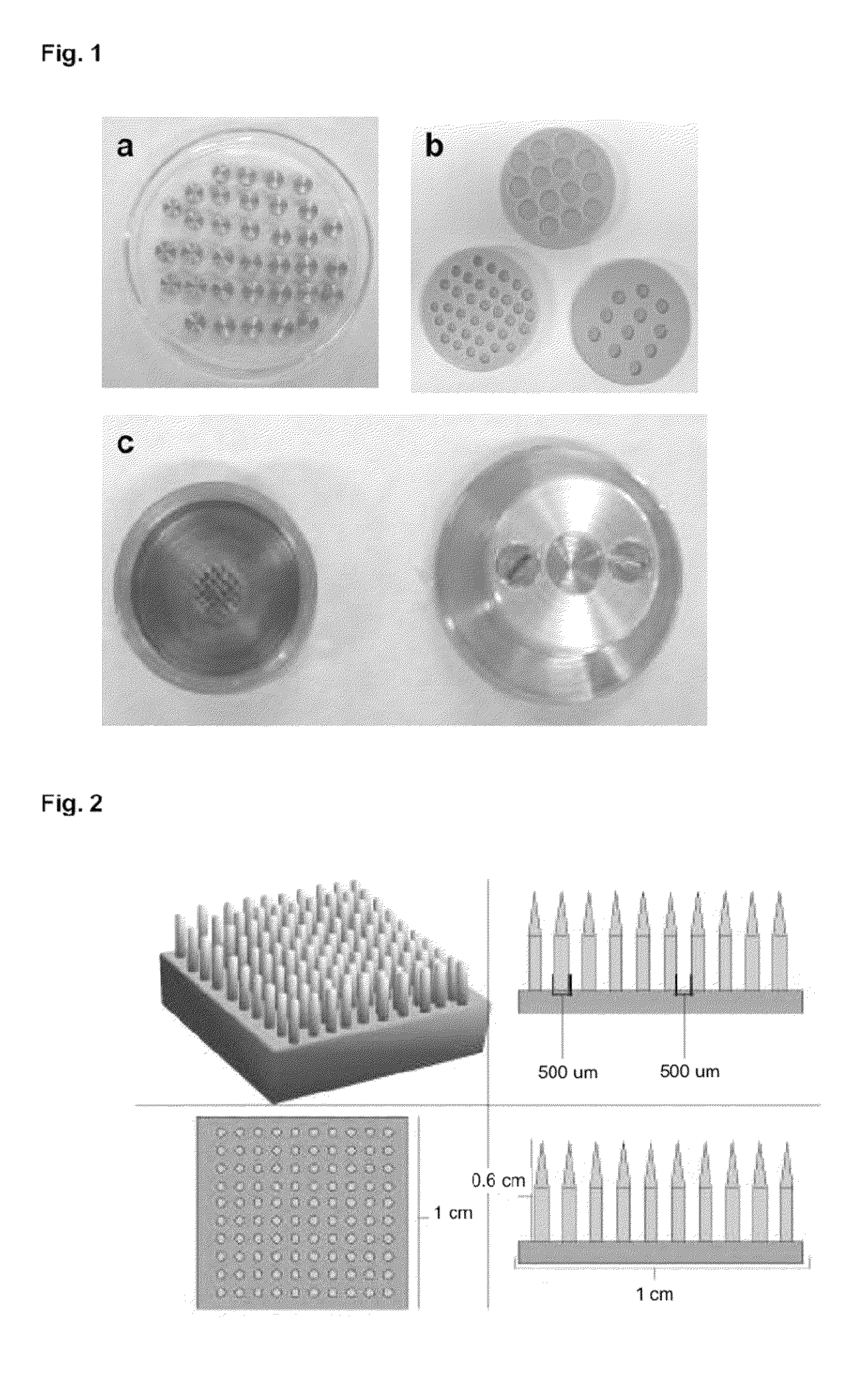 Three-dimensional matrices of structured porous monetite for tissue engineering and bone regeneration, and method of the preparation thereof