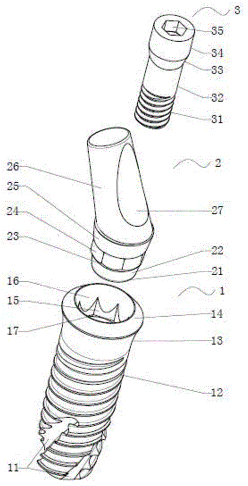 Artificial dental abutment, artificial dental multi-part implanting system and implanting method
