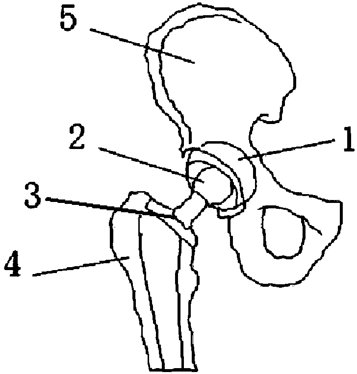 A kind of composite spherical head artificial hip joint