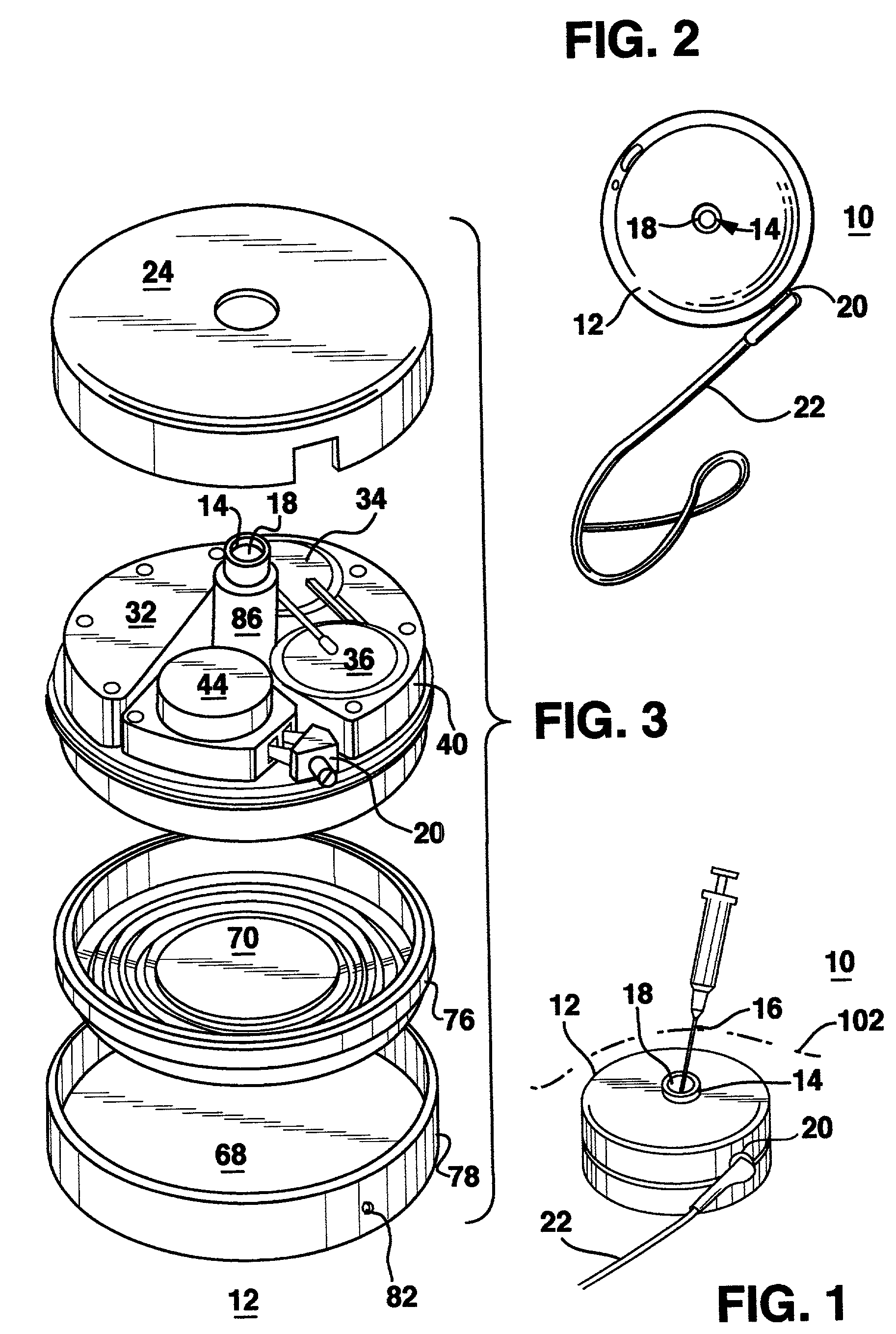 Methods and apparatus for delivering a drug influencing appetite for treatment of eating disorders