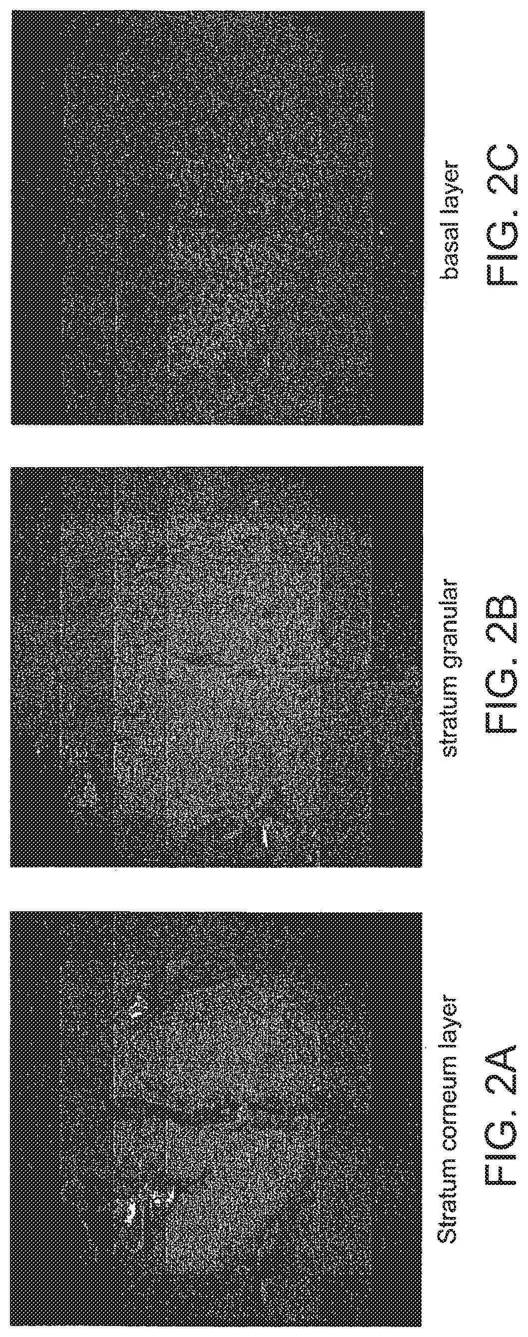 Multifocal imaging systems and method