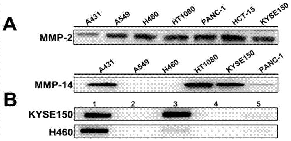 Preparation and application of a class of antineoplastic drugs based on matrix metalloproteinase tissue inhibitor-2