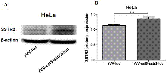 Recombinant vaccinia virus containing genes CCL5 and SSTR2 and preparation method of recombinant vaccinia virus