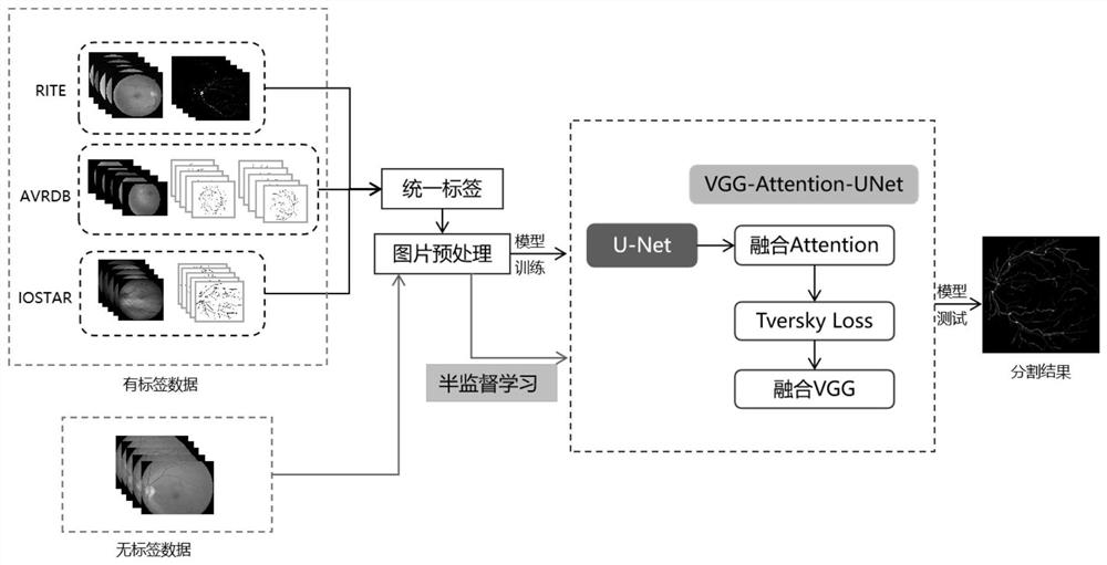 Method and system for calculating diameter of arteriovenous blood vessel of fundus retina