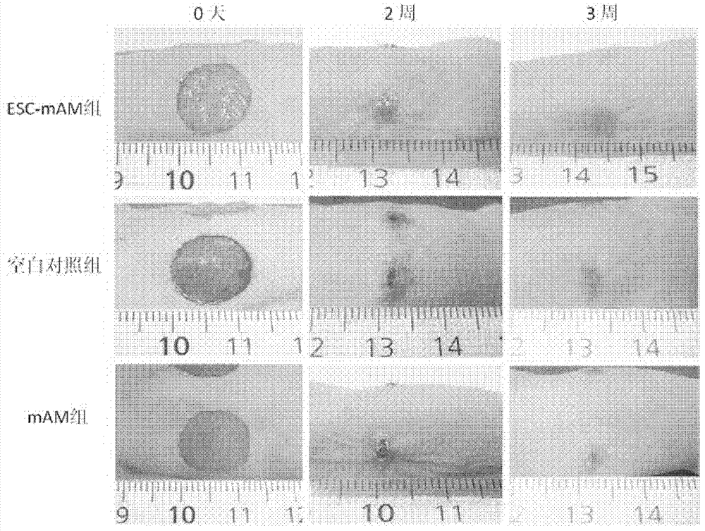 Amniotic membrane microcarrier capable of simulating niche microenvironment for growth of epidermal stem cells and skin substitute thereof