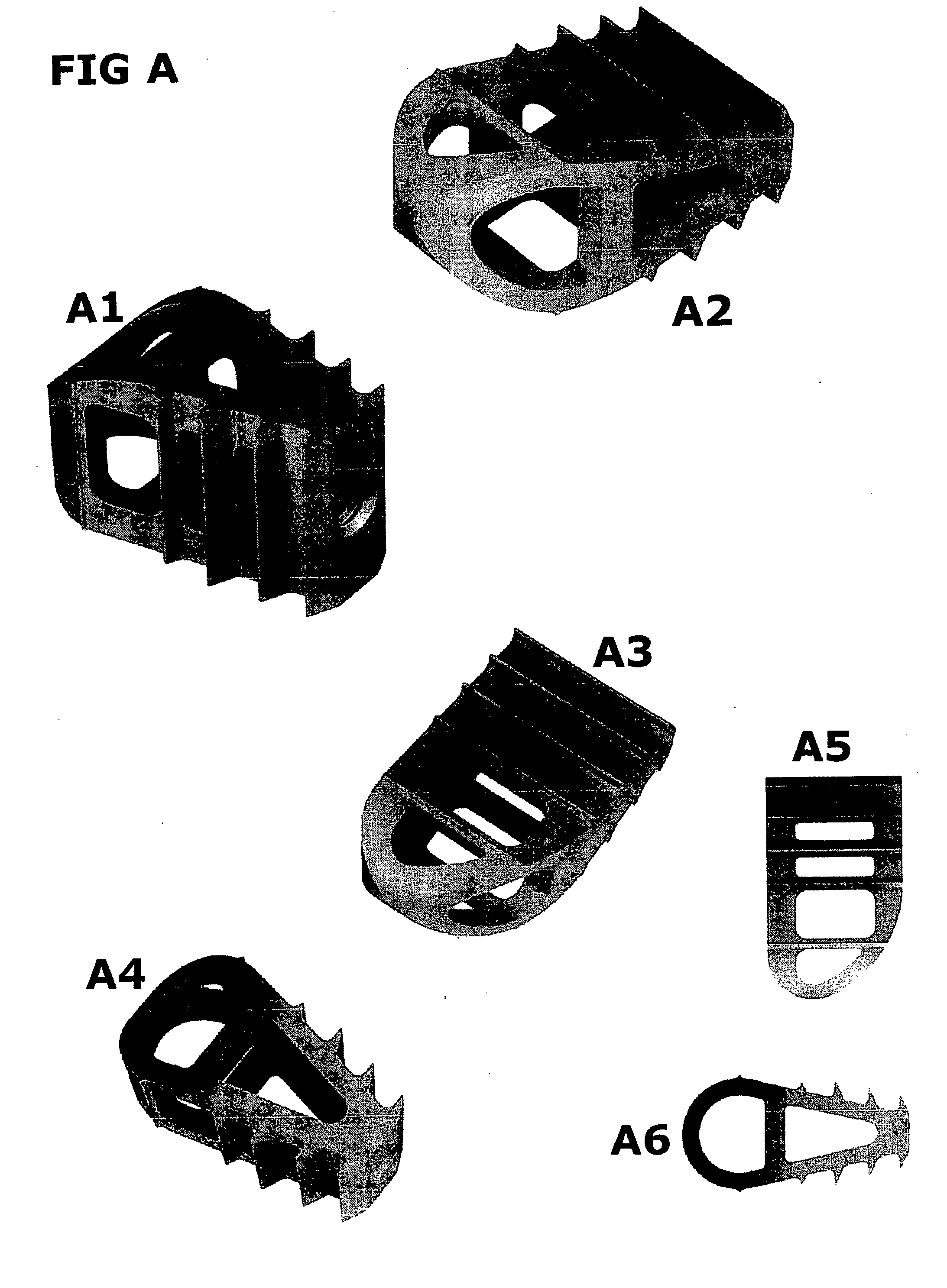Method for correcting a deformity in the spinal column and its corresponding implant