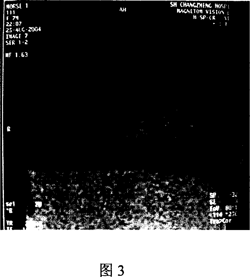 Magnetic resonance tumour target contrast media and preparing method thereof