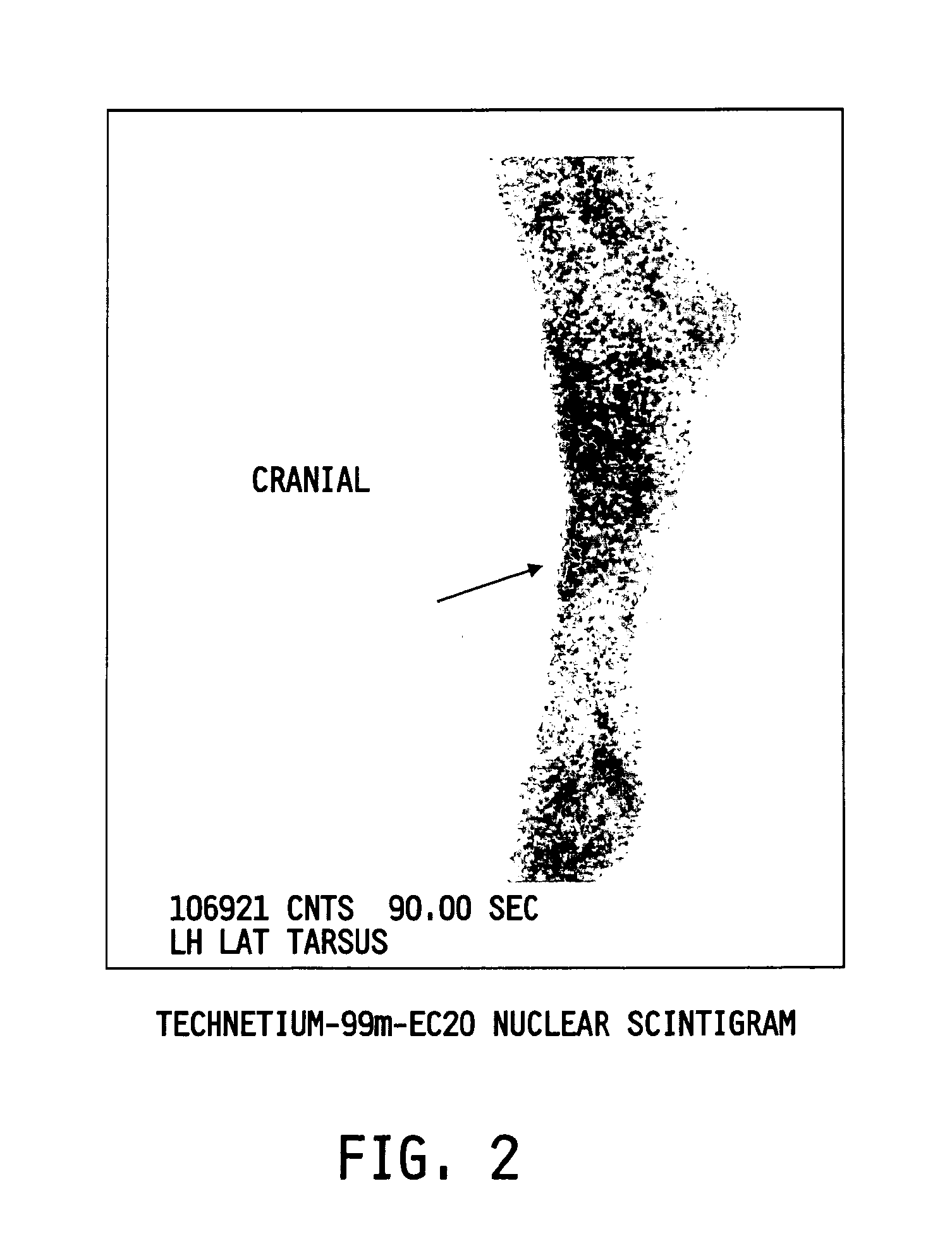 Method of imaging localized infections