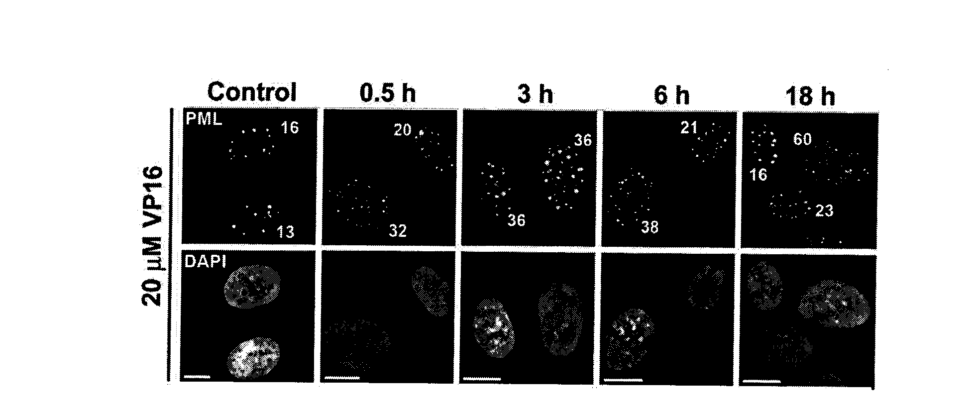 Methods for measuring cell response to DNA damaging agents using promyelocytic leukemia protein nuclear bodies