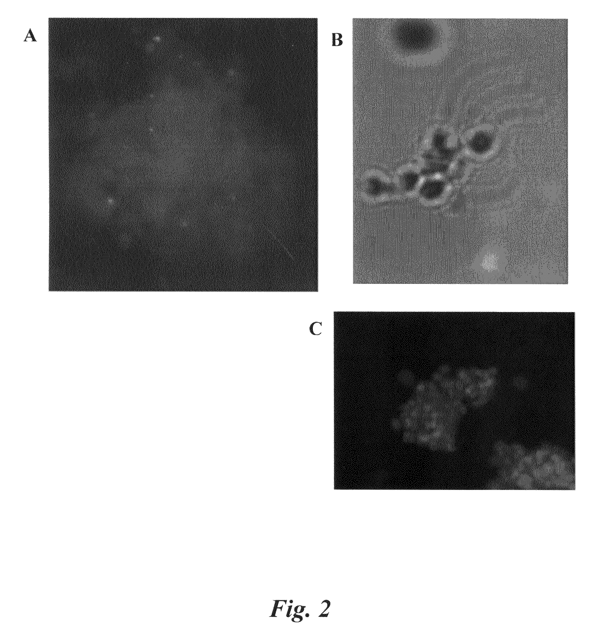 Methods for preparing and analyzing cells having chromosomal abnormalities