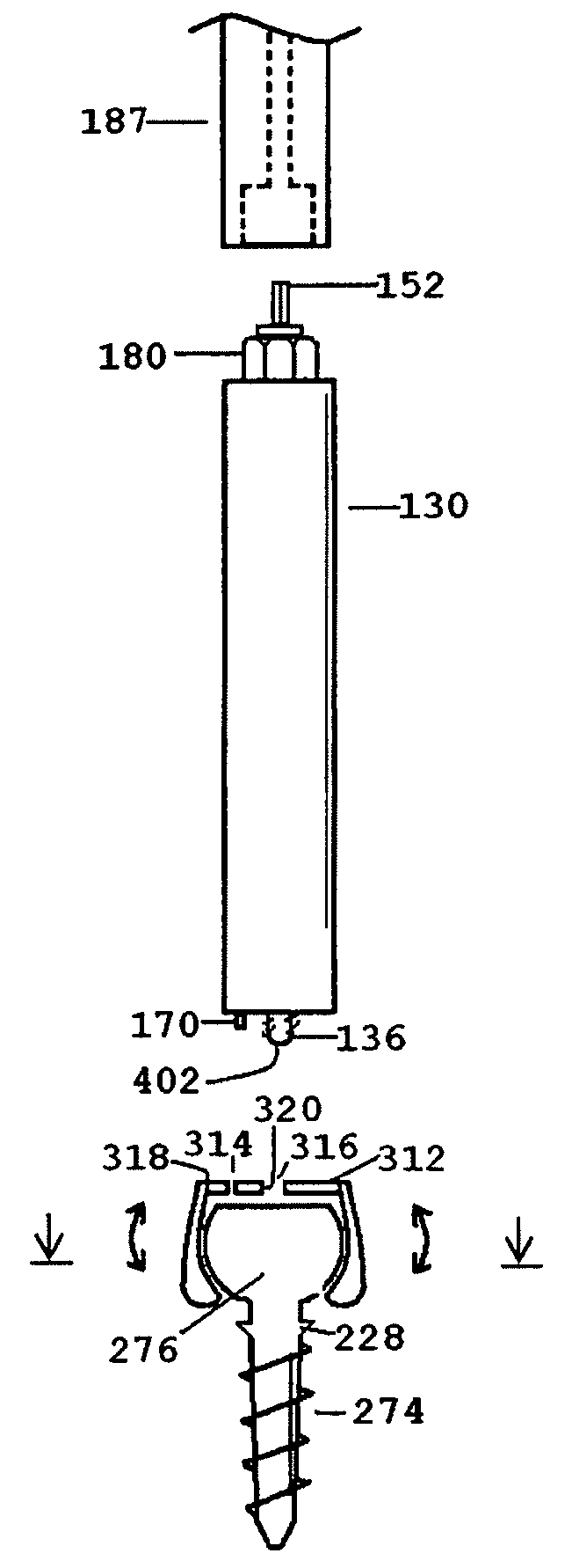 Distraction screw for skeletal surgery and method of use
