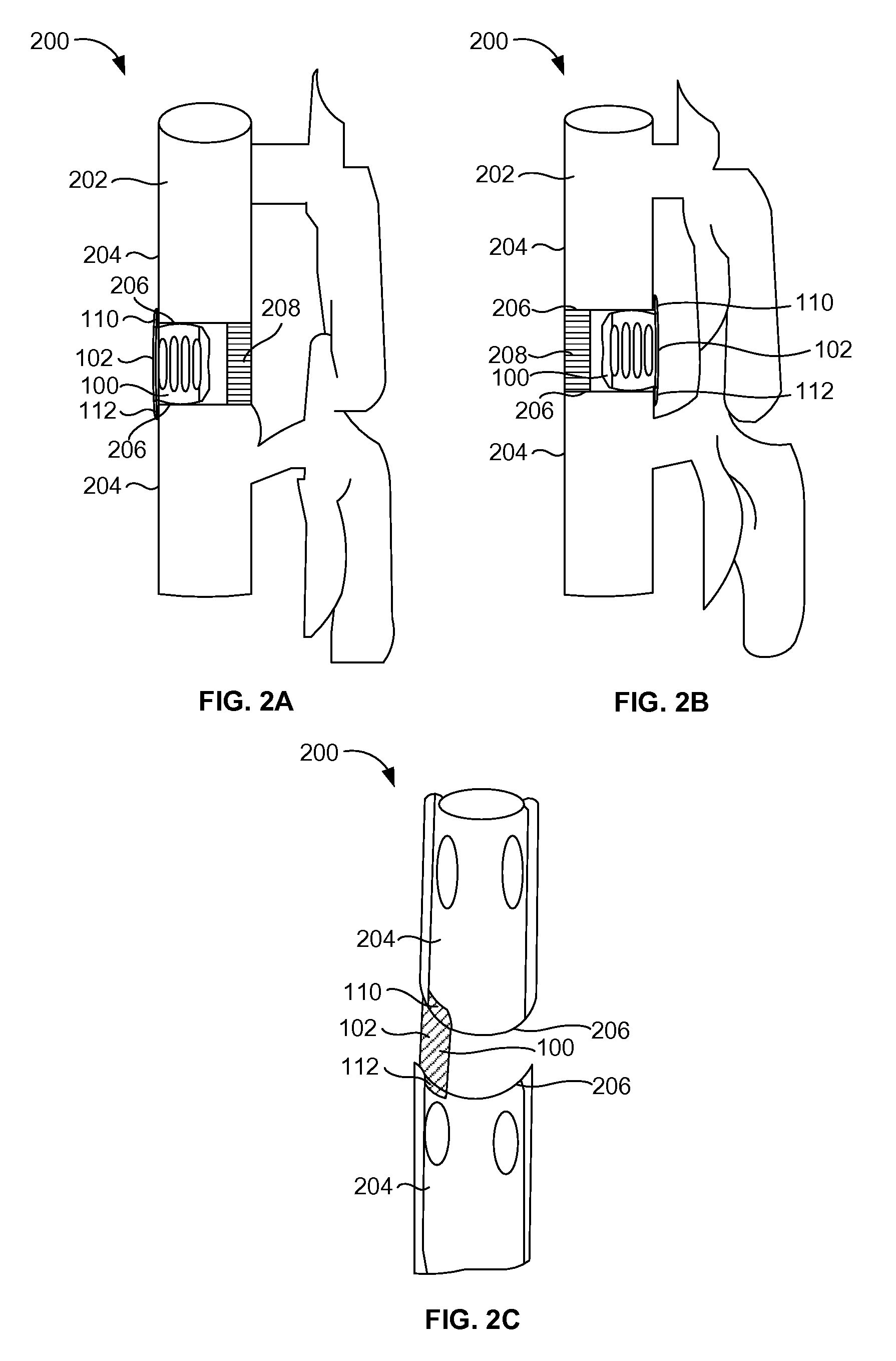 Flanged interbody device