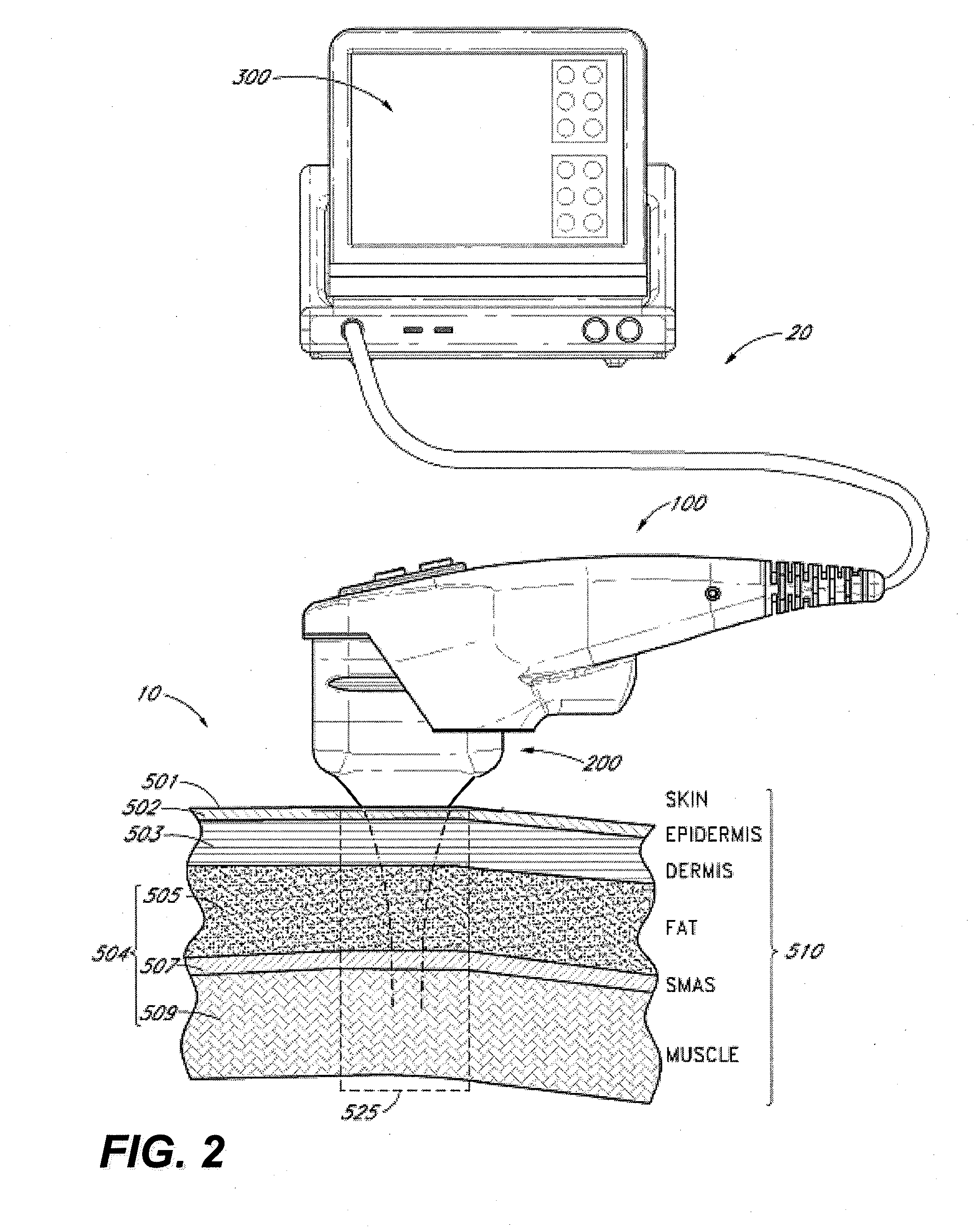 Devices and methods for multi-focus ultrasound therapy