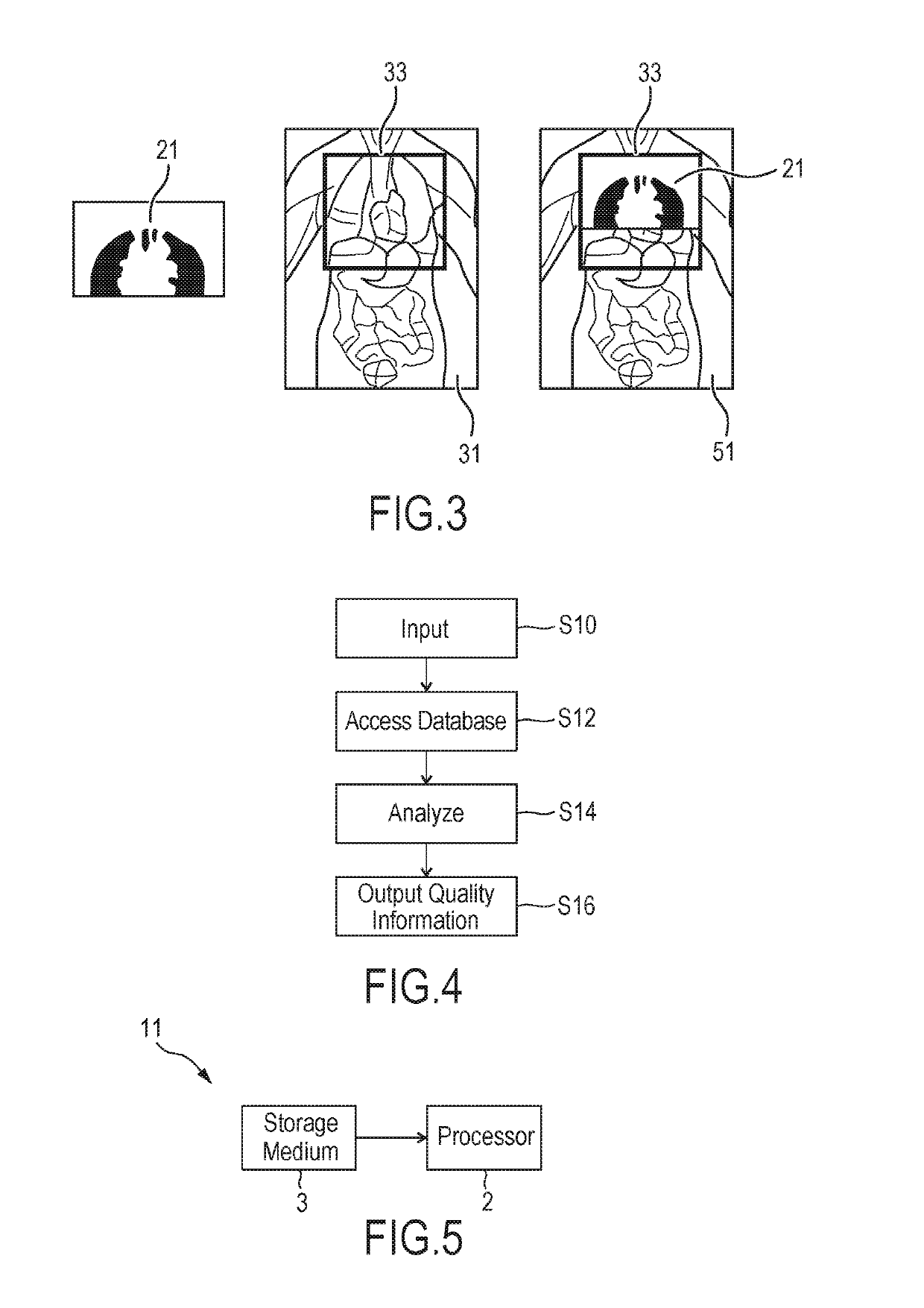 Device, system and method for quality assessment of medical images