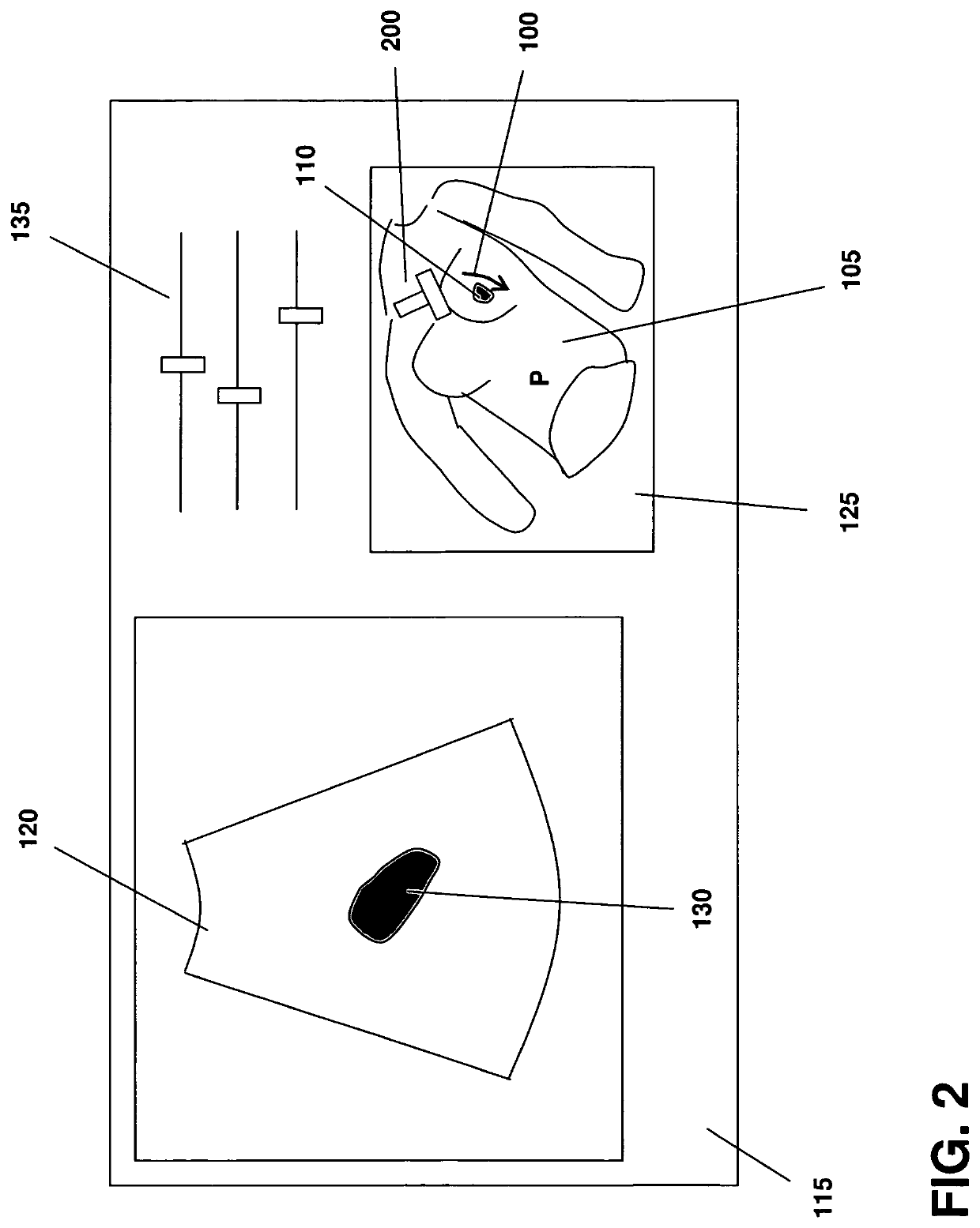 Methods and systems for guiding the acquisition of ultrasound images