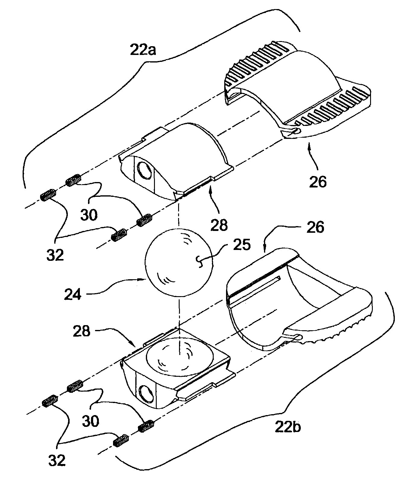 Articular disc prosthesis and method for implanting the same