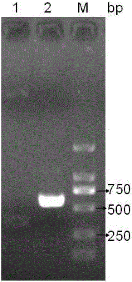 Lactic acid bacterium double-gene expression box and construction method and application of lactic acid bacterium double-gene expression box