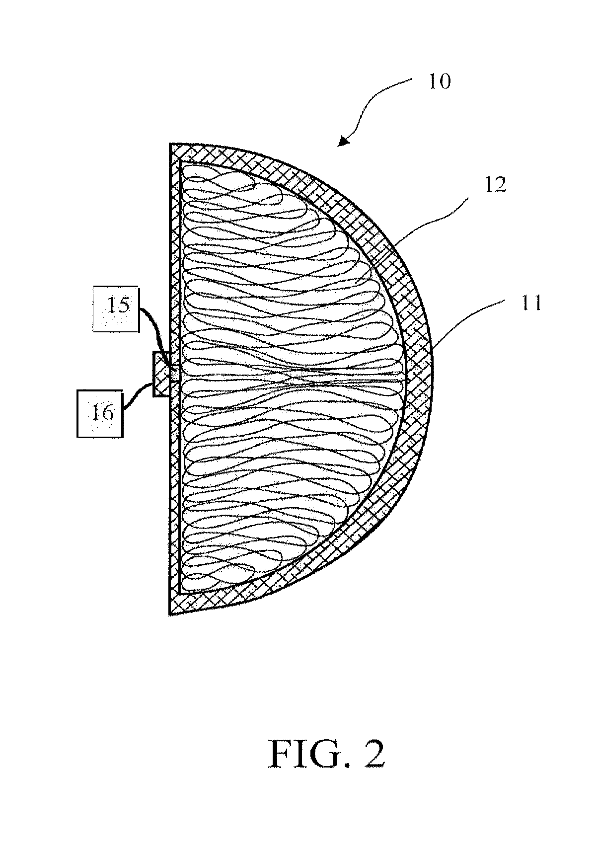 Breast implants and methods of manufacture