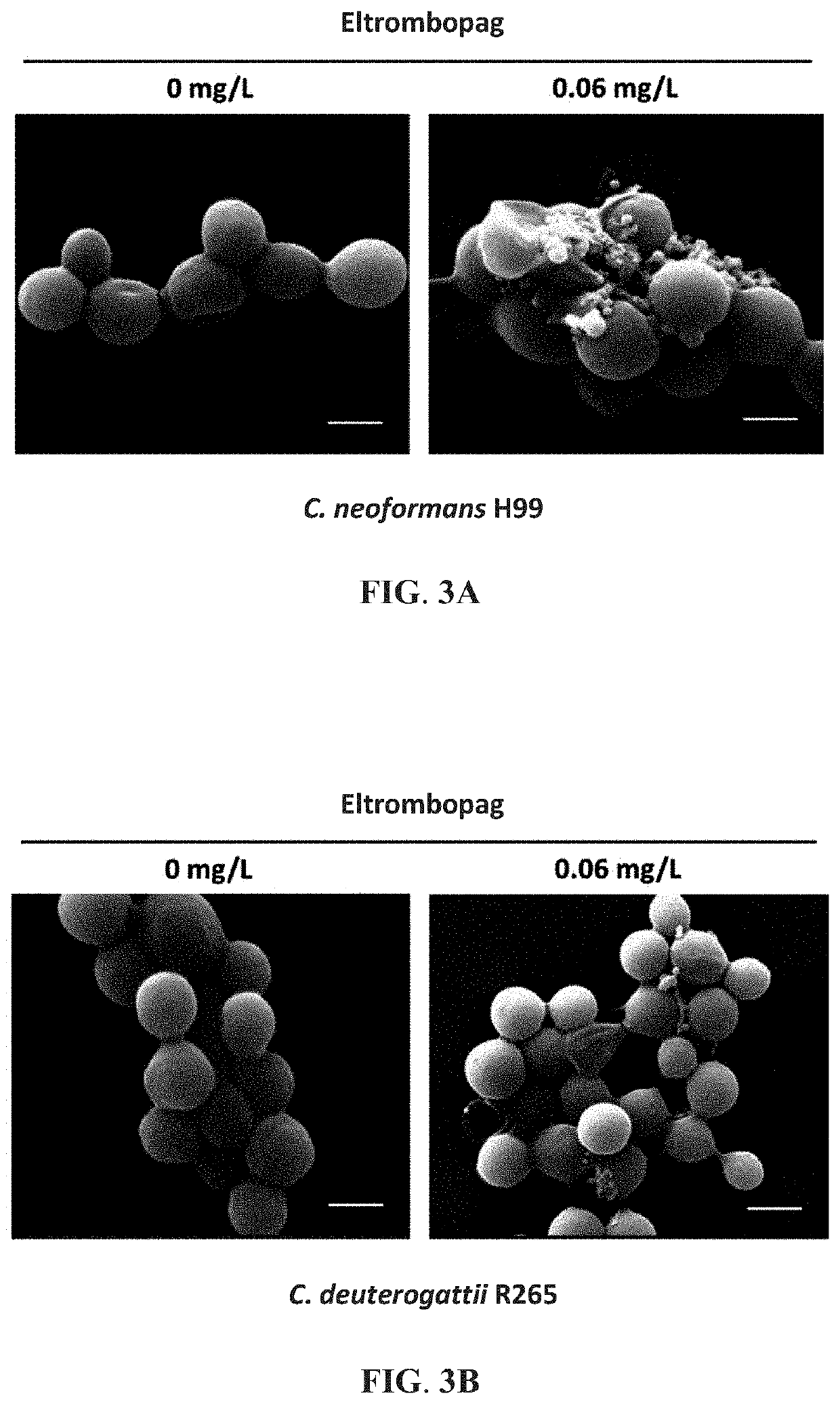 Method of inhibiting cryptococcus growth using eltrombopag