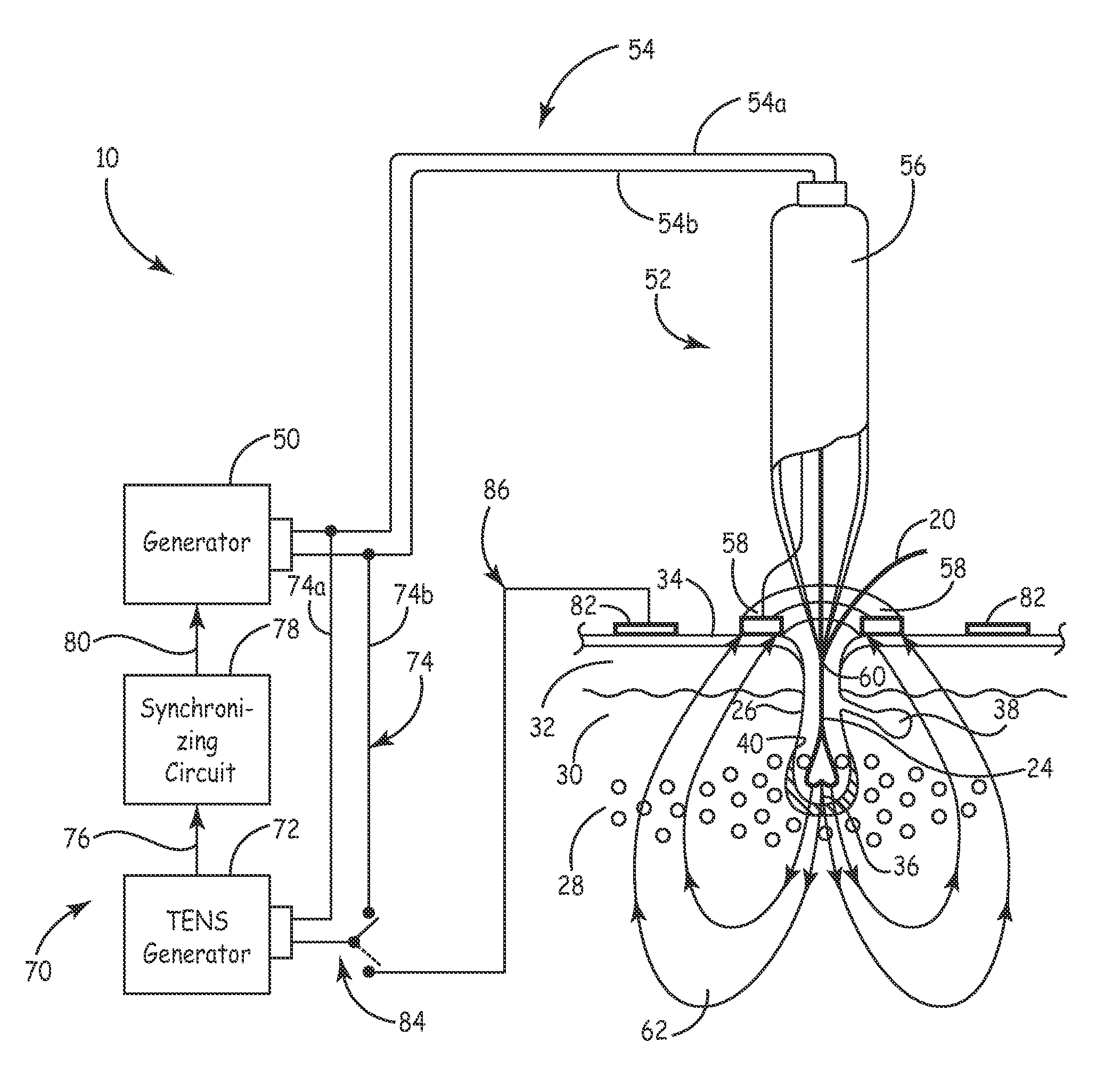 Apparatus and method for hair removal by electroporation