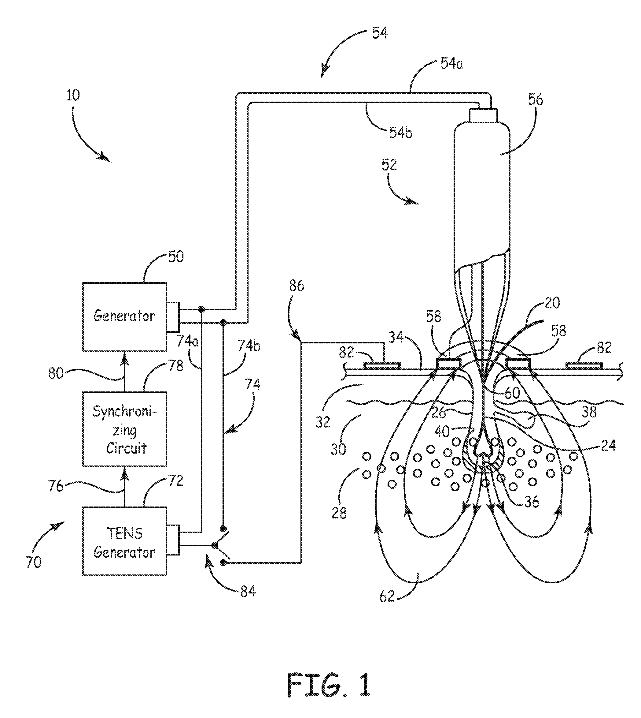 Apparatus and method for hair removal by electroporation
