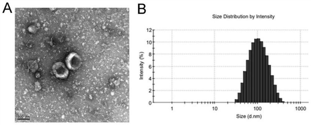 Composite exosome loaded with cRGD and small-molecule antitumor drug as well as preparation method and application of composite exosome