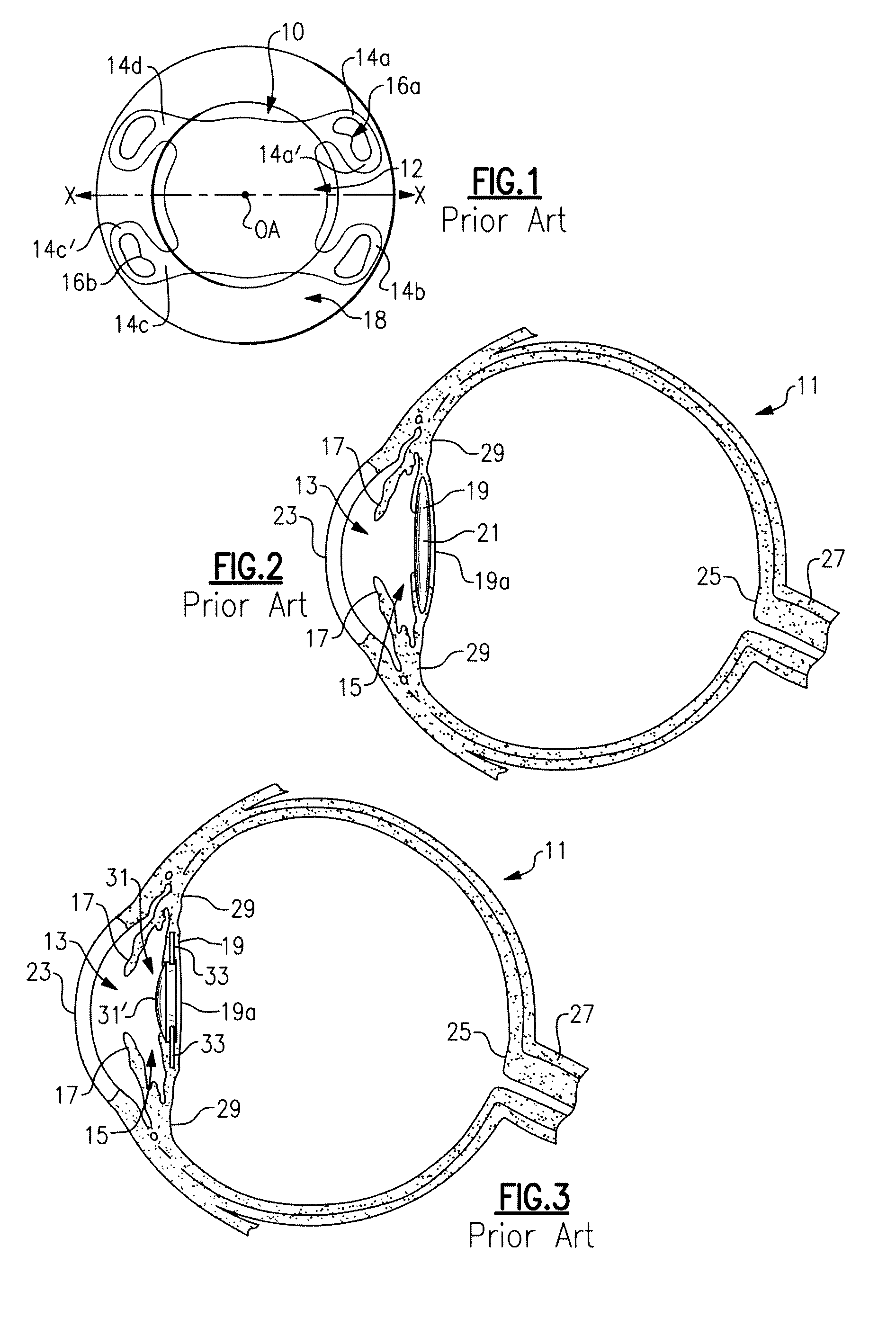 Intraocular Lens and Method of Making an Intraocular Lens