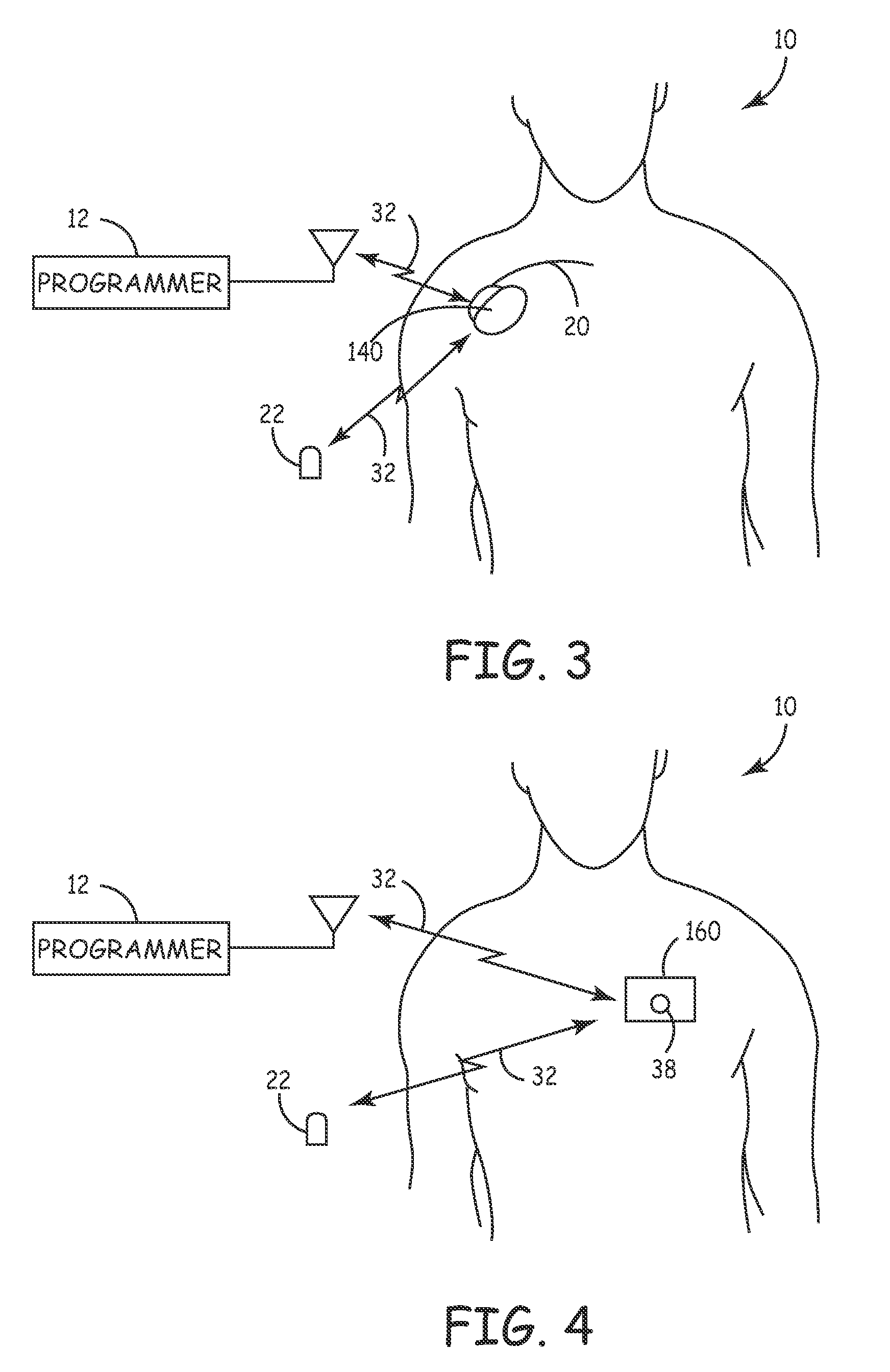 System and method for using cardiac events to trigger therapy for treating nervous system disorders